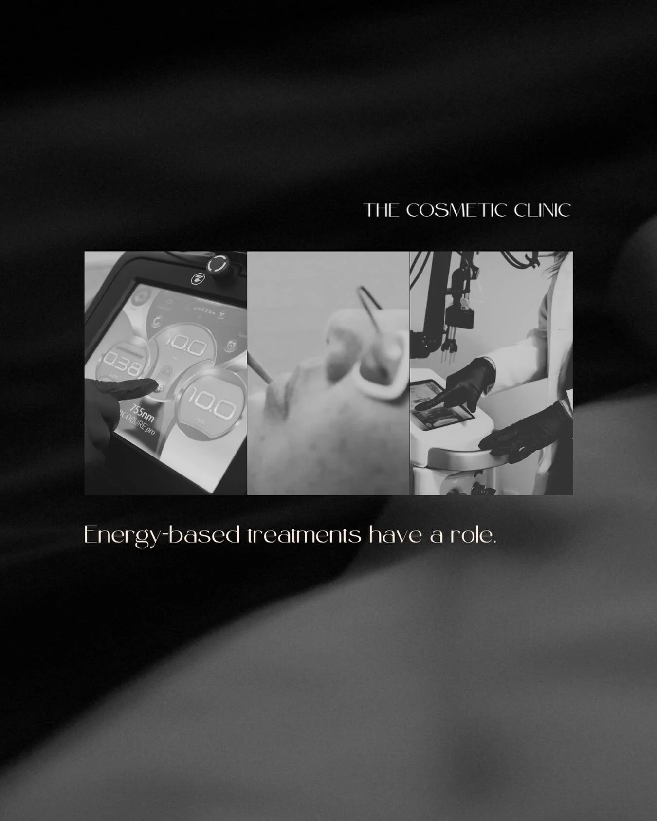 Energy-based treatments have a role. 

Potenza is one example.

When introduced at the right point, it can support collagen and skin structure. 

That point is not the same for everyone. 

It depends on skin condition, tolerance, and what&rsquo;s alr