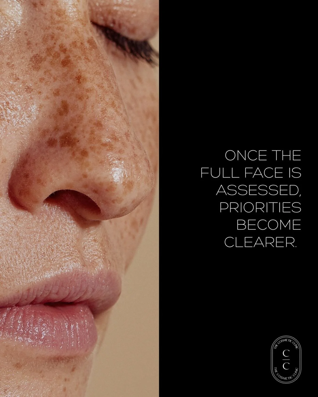 Most patients arrive with a sense of what they need. 

A consultation can change that. 

Once the full face is assessed, priorities become clearer. 

Skin quality. Movement. Structure. 

What needs attention now is often different than what first bro