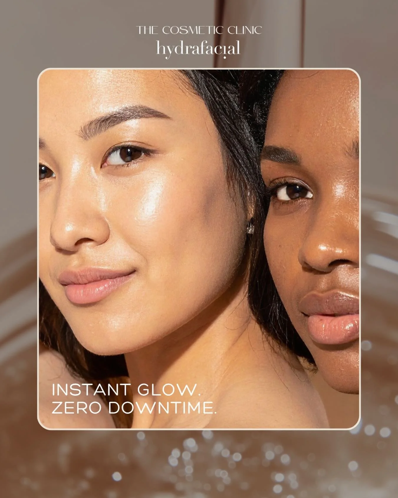 Hydrafacial becomes part of many treatment plans this time of year. 

Weddings. 
Travel. 
Summer events. 
Photos. 

We also love it before larger treatment plans and devices when the skin needs hydration, exfoliation, and barrier support first. 

Ski