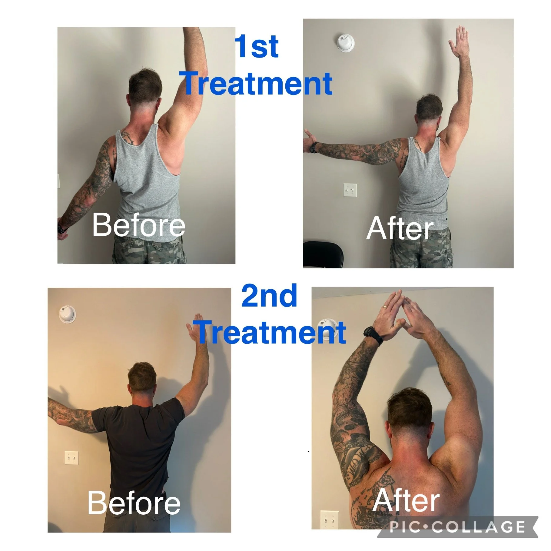 Side-by-side before and after photos of a man showing improvements in shoulder and arm mobility and muscle tone after a first and second treatment, with text overlay indicating the progression.
