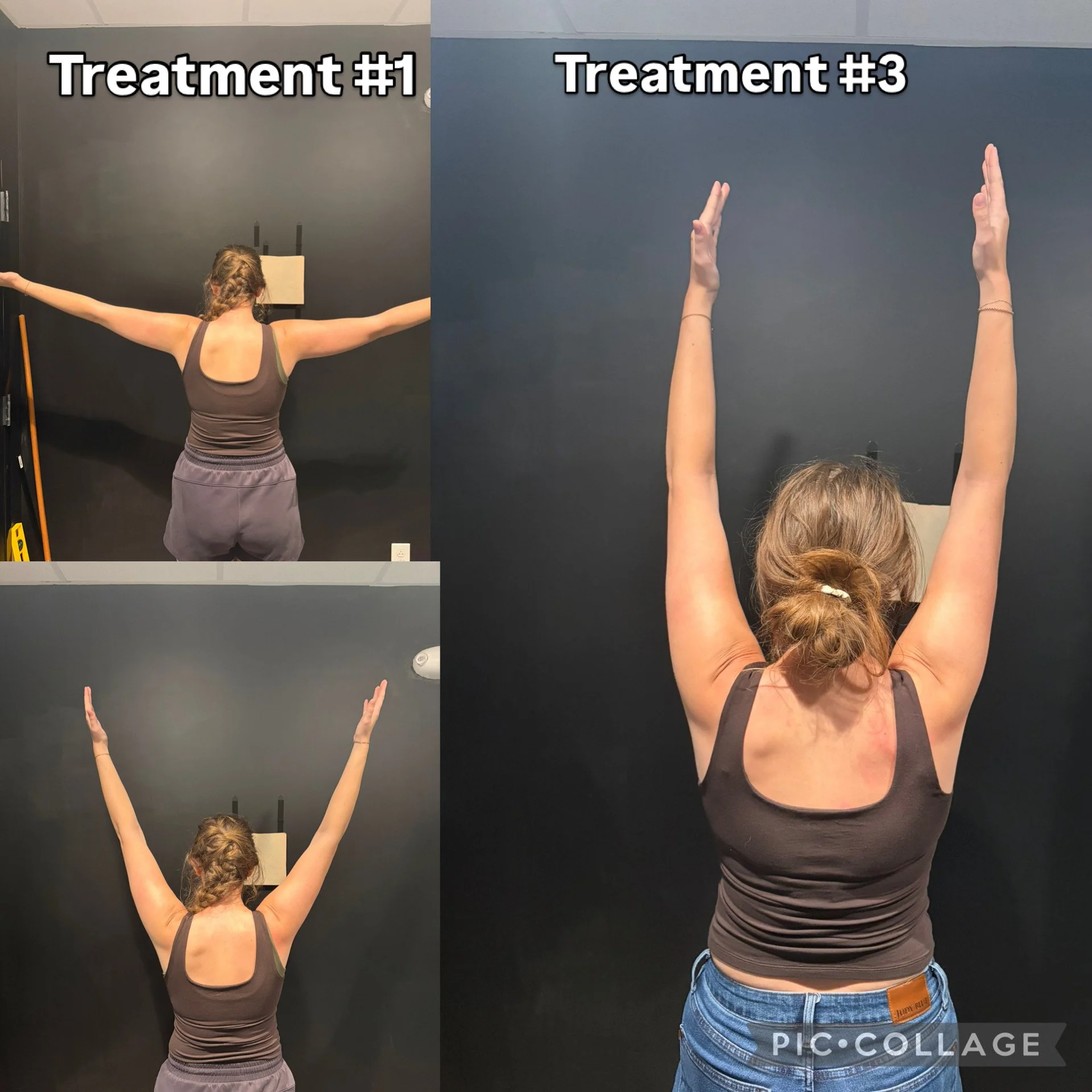 Comparison of two therapy treatments on skin appearance, with labeled treatments #1 and #3, showing changes in skin condition.
