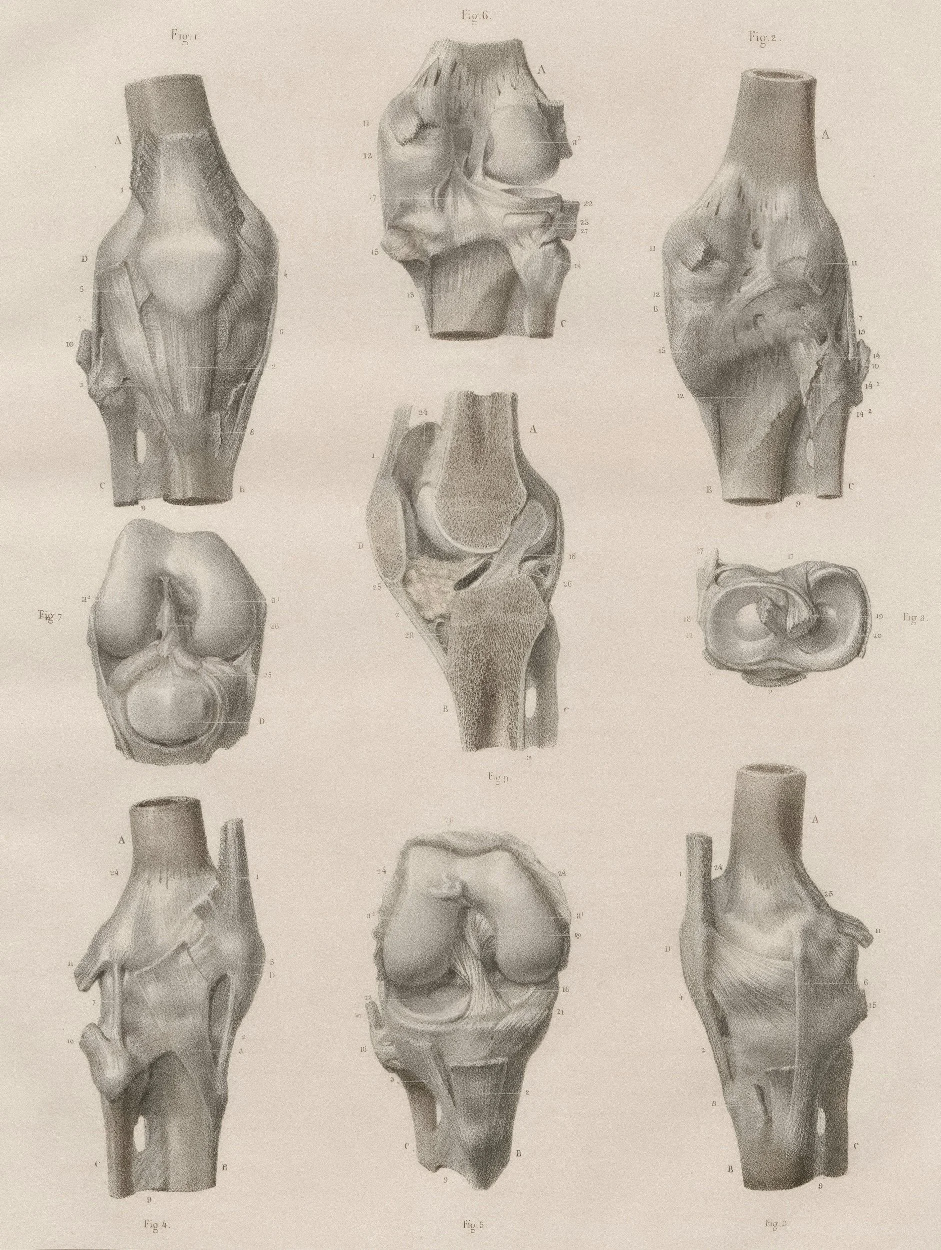 Anatomical illustration showing knee joint structures including bone, cartilage and ligaments.