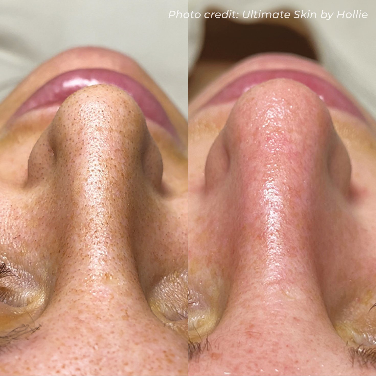 BA31_ULTIMATESKINBYHOLLIE_HO2_FACE_X1.jpg
