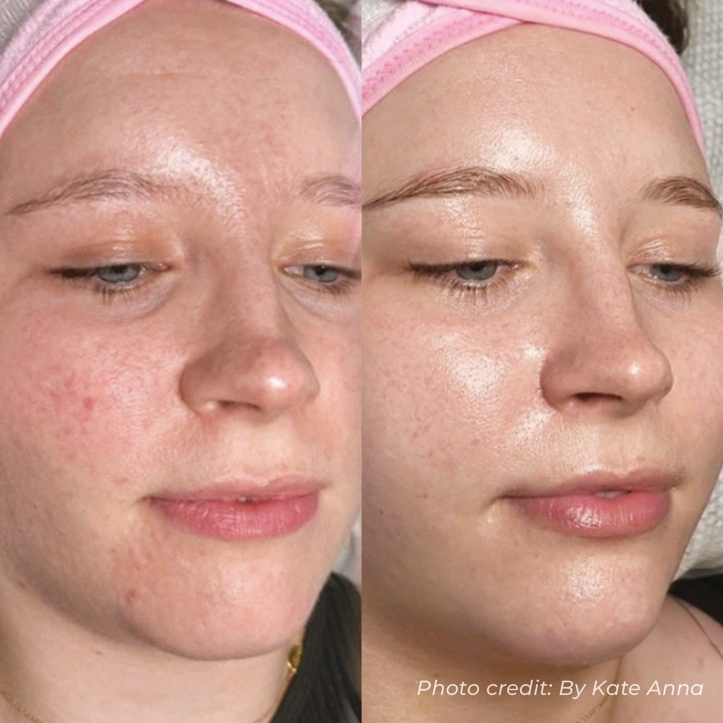 BA29_BYKATEANNA_HO2_FACE_X1.jpg