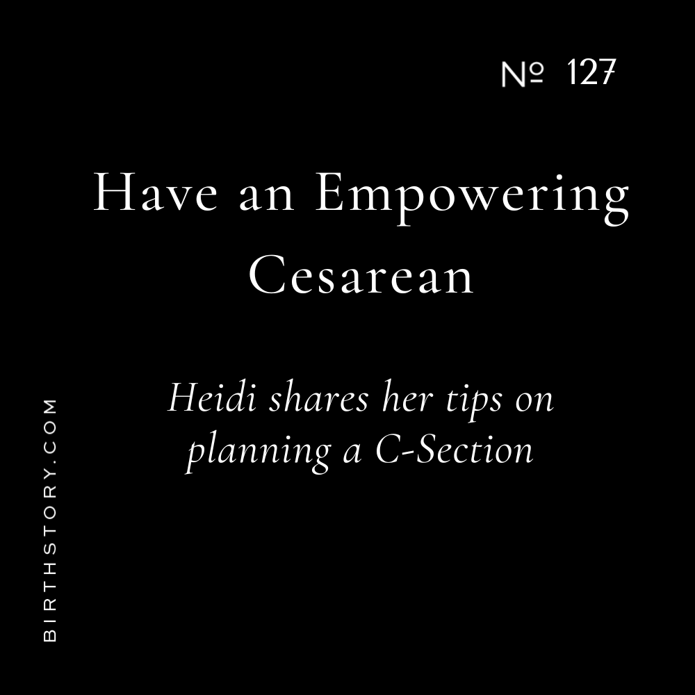 127 Pro Tips for an Empowering Scheduled Cesarean