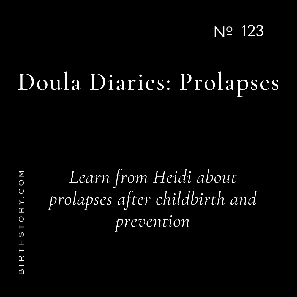 123 Is that a penis growing out of my vagina? Doula Diaries: Prolapses