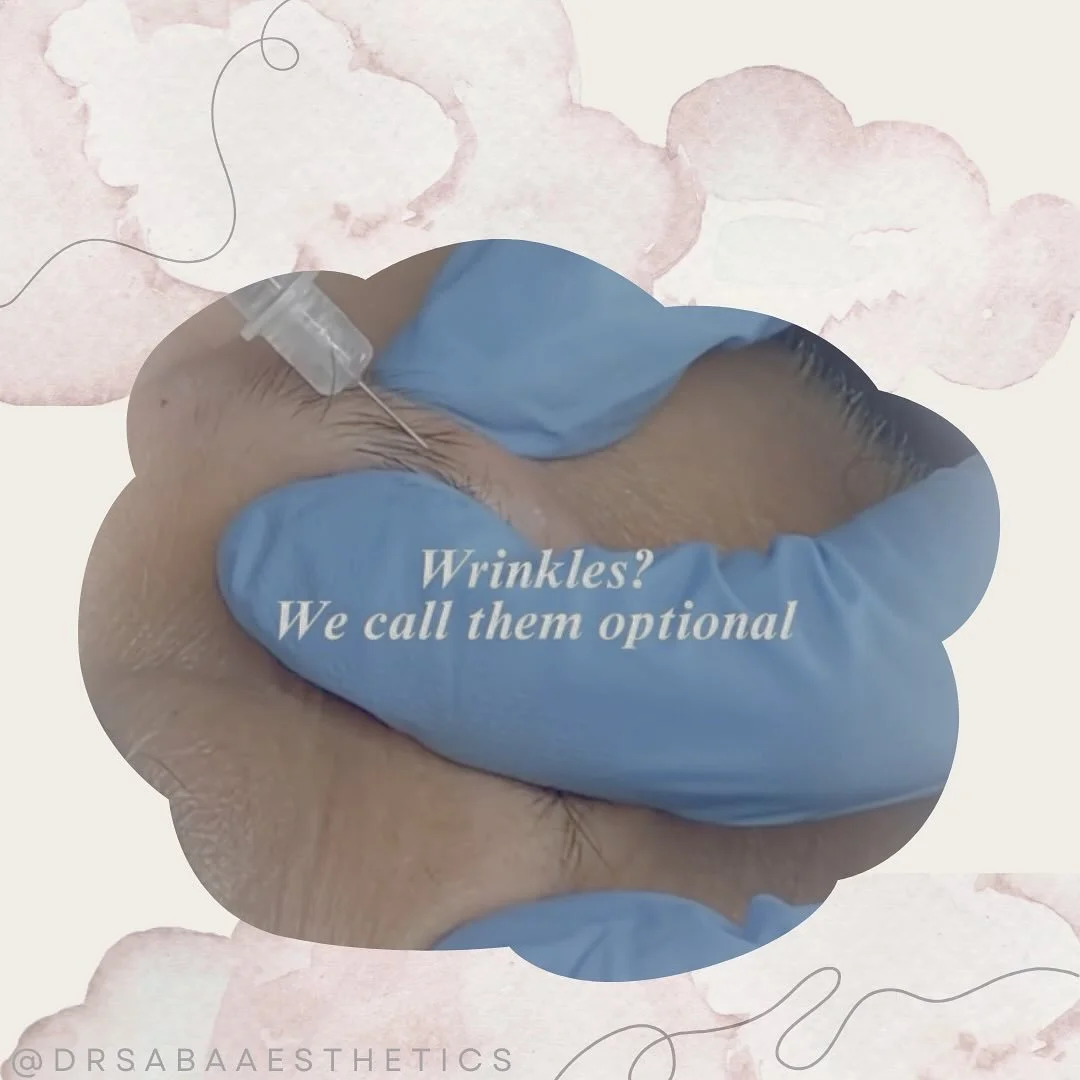 πA handy guide to Anti Wrinkle Treatments π
π Botox or Anti Wrinkle treatments can be used to reduce the appearance of fine lines, temporary paralyse muscles or sweat glands to achieve a cosmetic effect.
π² At Dr. Saba Aesthetics, we can tackl