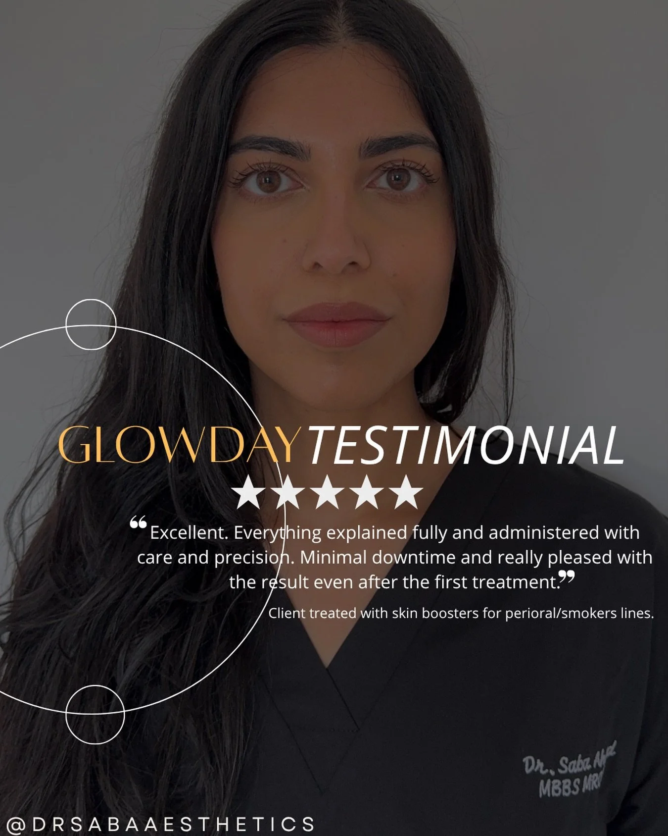 One of my clients was keen to avoid filler in the perioral area, so we chose a skin booster treatment called Sunekos instead; after noticing visible improvement following the first session, we completed a further two treatments around the mouth to he