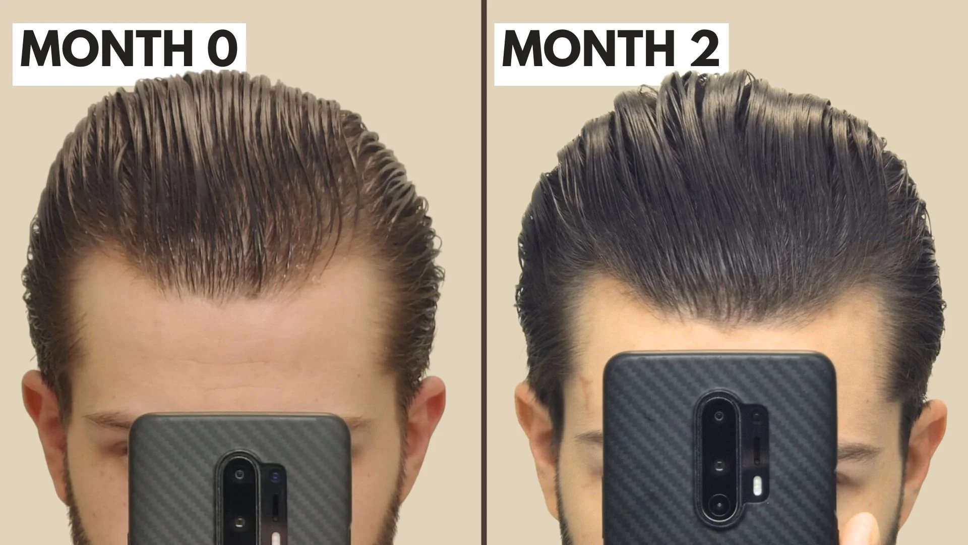 My hair results on the big 3 (before and after).