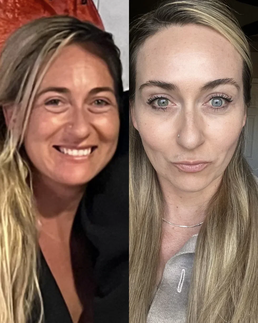 Functional health inflammation transformation