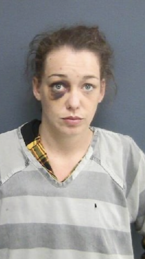 A woman with messy hair and a black eye, wearing a striped prison uniform, standing against a blue wall.