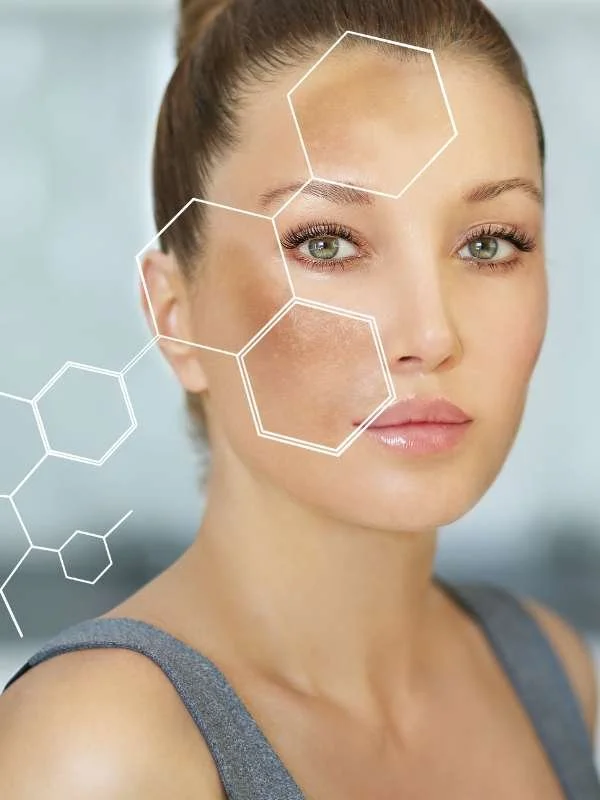 Hyperpigmentation vs. Melasma: Understanding the Differences and Best ...