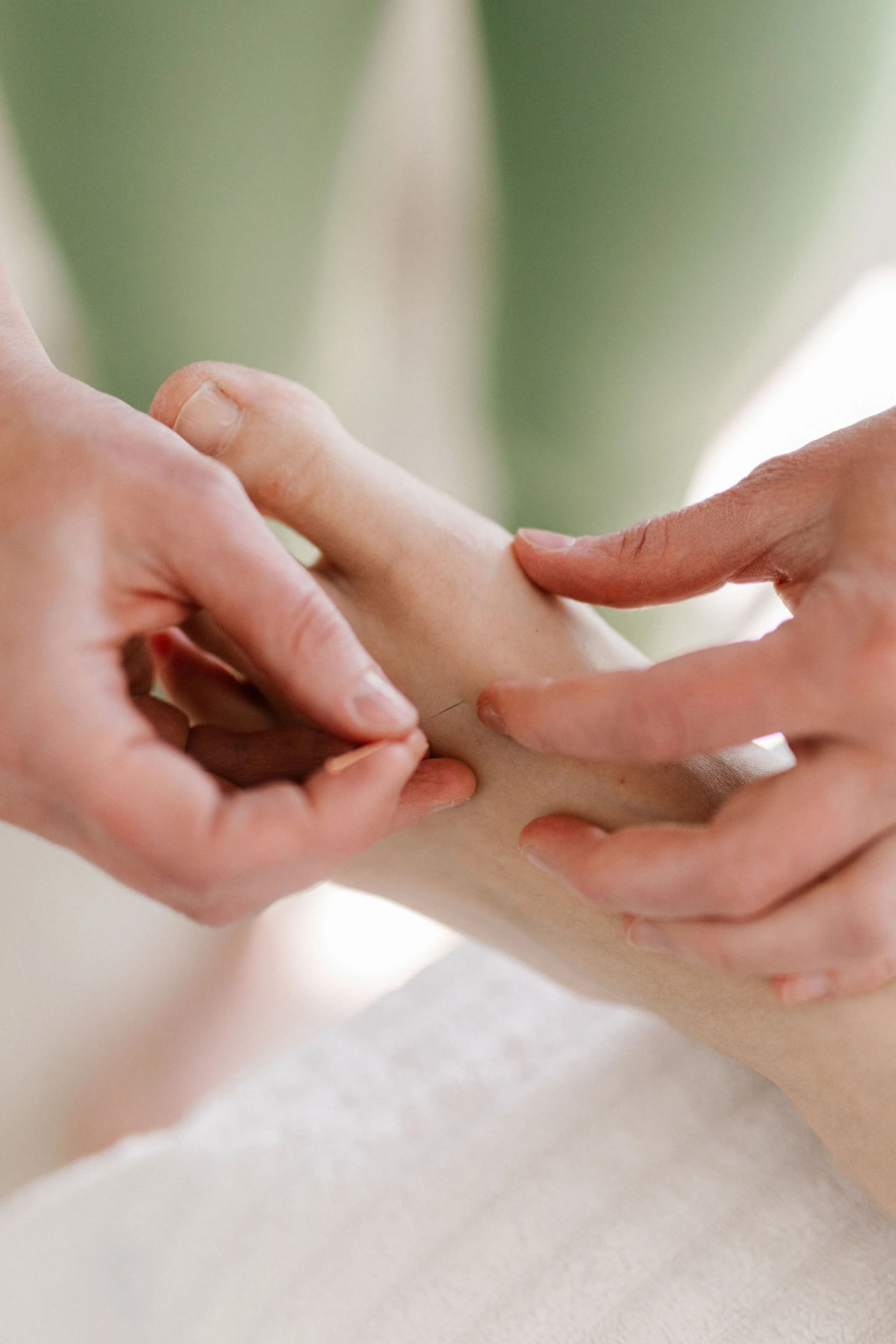 Kaksi ihmisen kättä, jotka tekevät akupunktiohoitoa tai hierontaa.