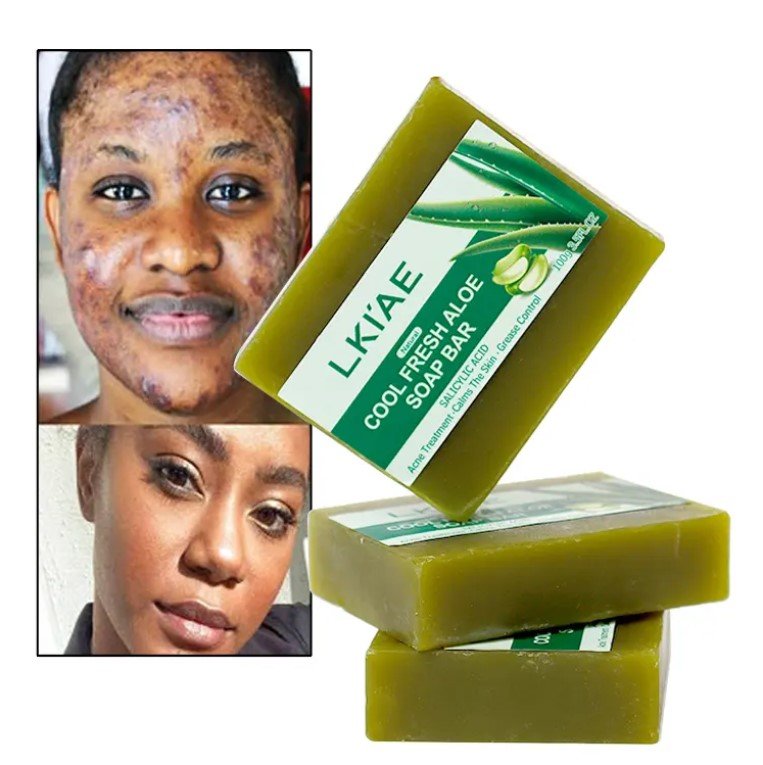 aloe soap.jpg