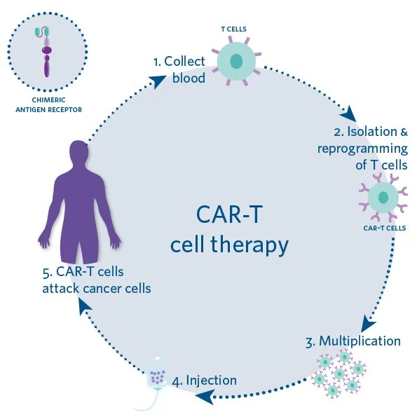 CAR-T Cell Therapy.jpg