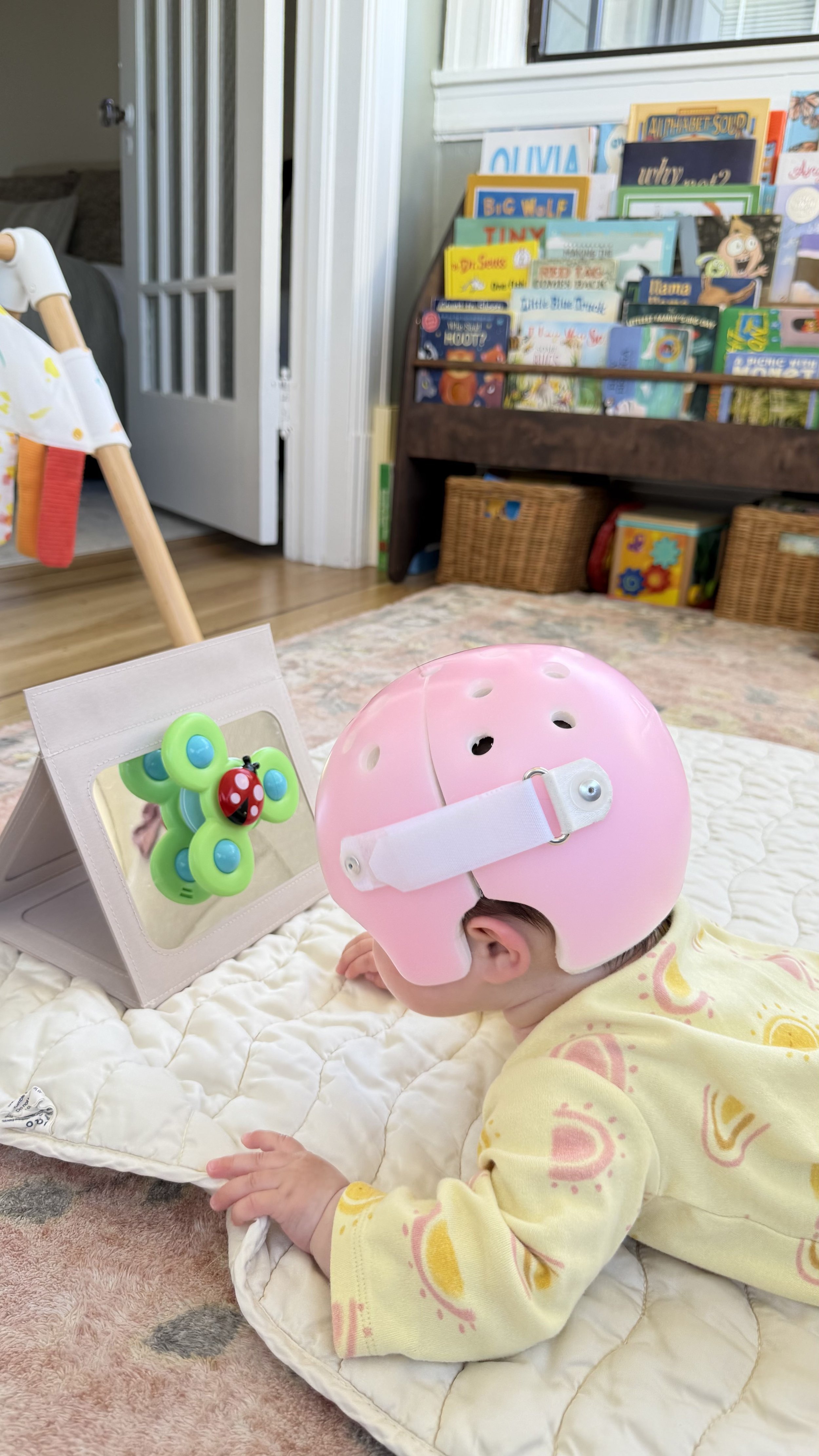 Baby wearing a pink cranial remodeling helmet doing supervised tummy time while looking at a sensory mirror — helmet therapy and physical therapy working together to support head shape and development