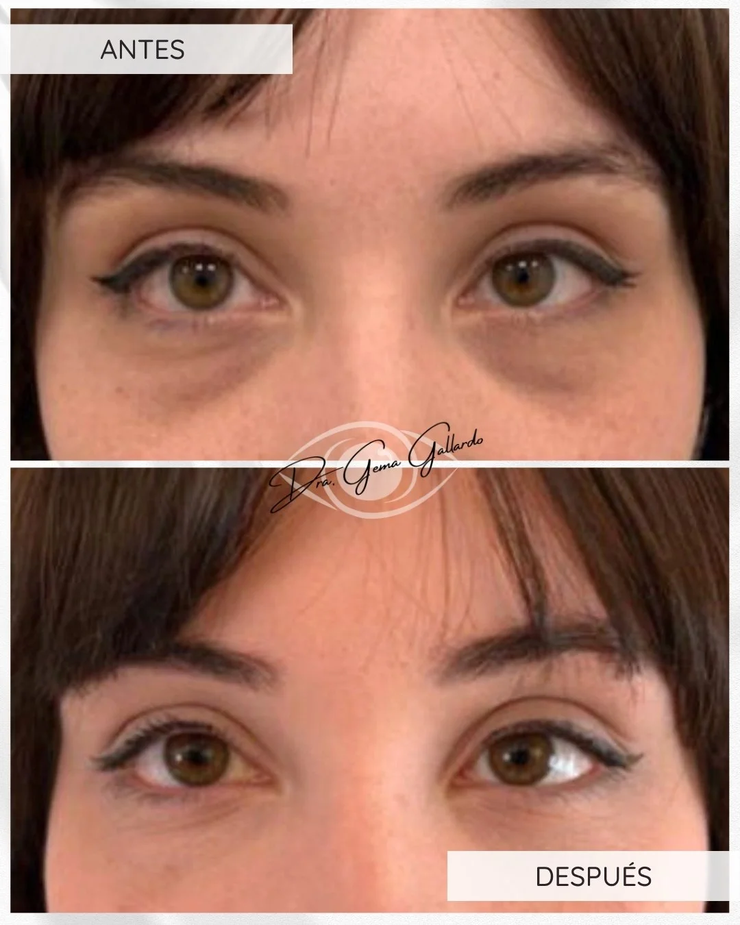 Neuromodulación (6).jpg