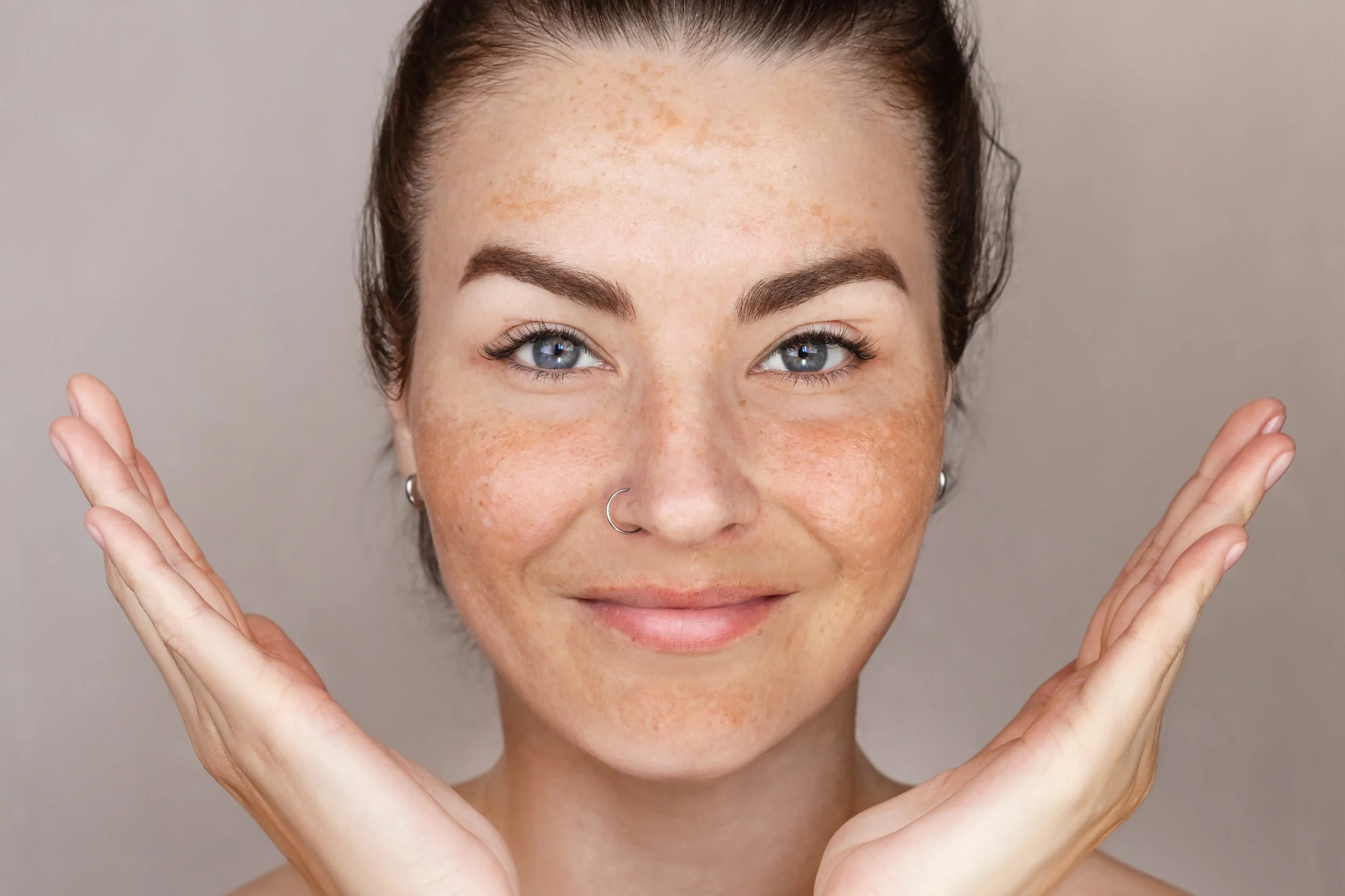 Close-up of a woman with clear, freckled skin and blue eyes, smiling with her hands near her face.