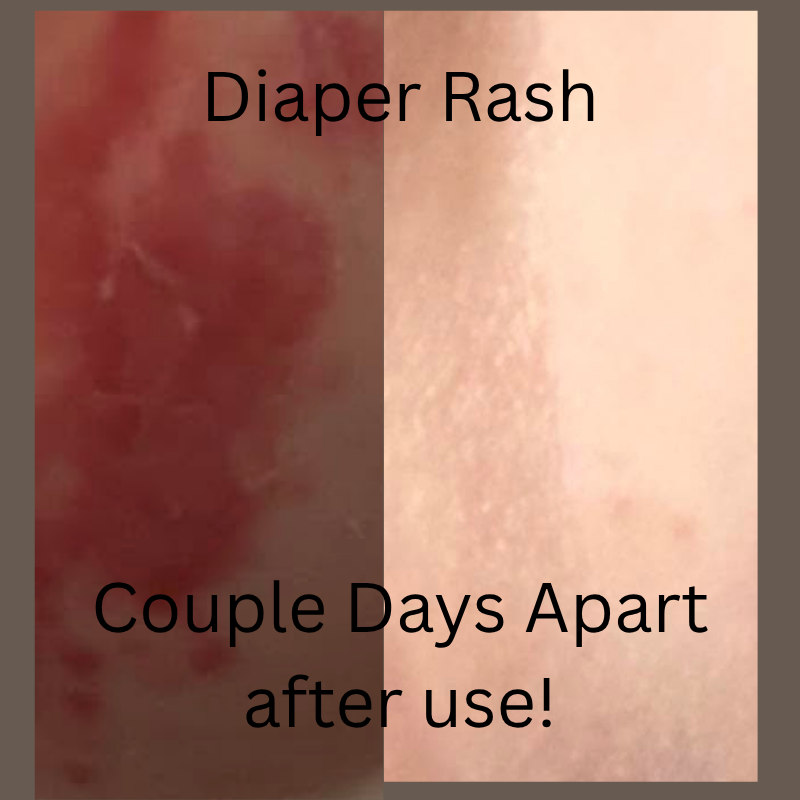 b.png