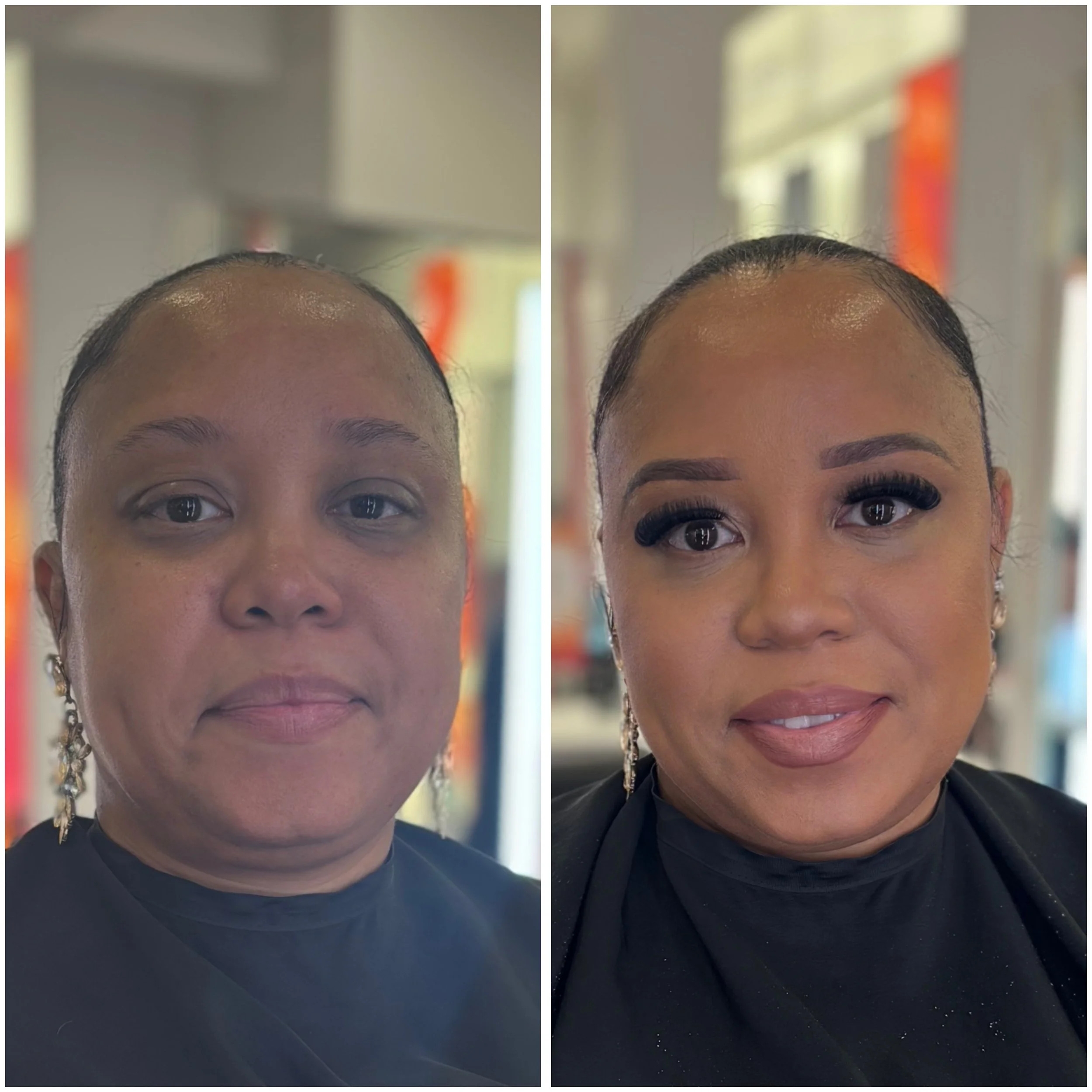 Comparison of a person's forehead and eye area before and after a beauty treatment, showing smoother skin and enhanced eyelashes in the after photo.