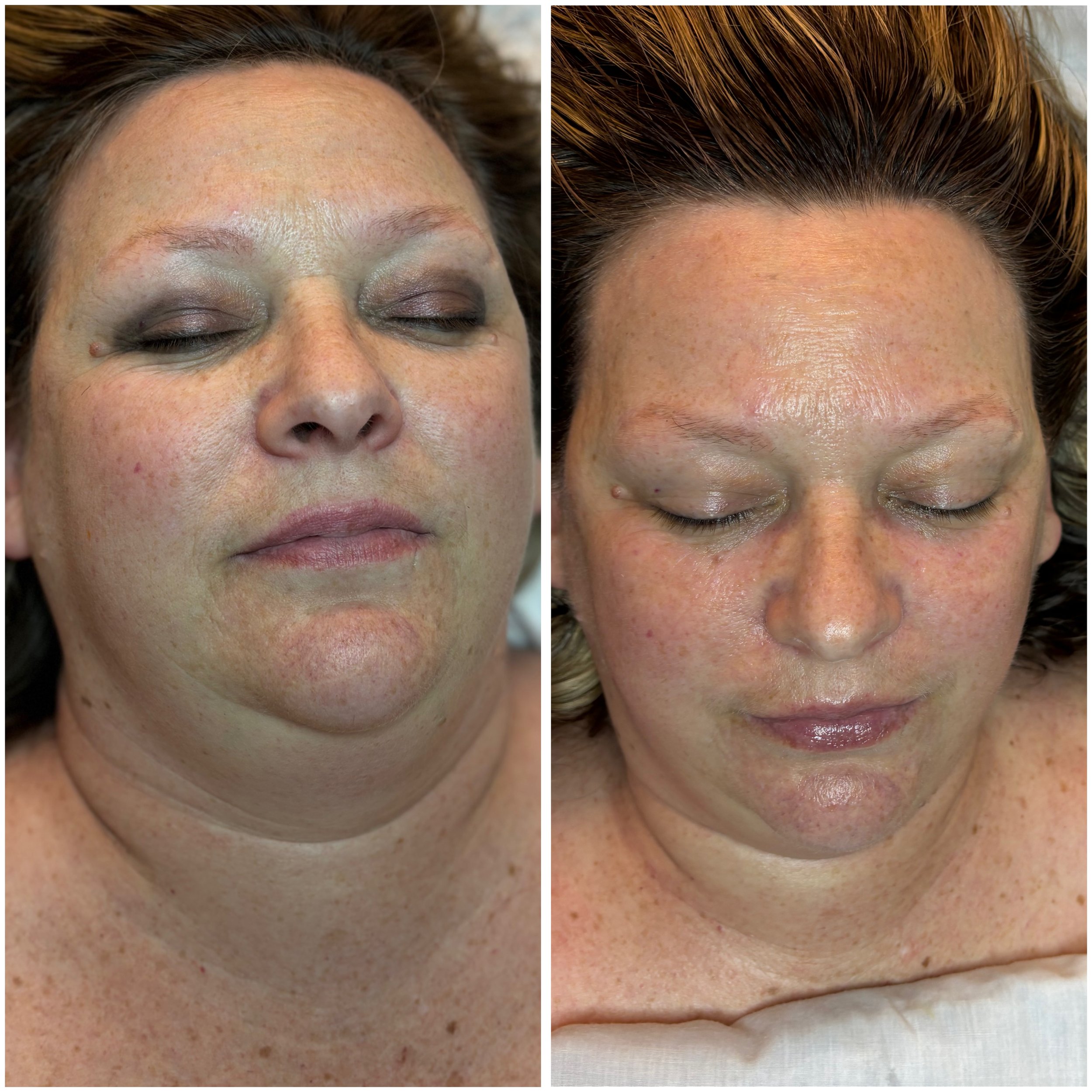 Side-by-side close-up images of a woman's face showing before and after cosmetic treatment of her eyebrows, with the before image on the left displaying sparse eyebrows and the after image on the right showing fuller, more defined eyebrows.