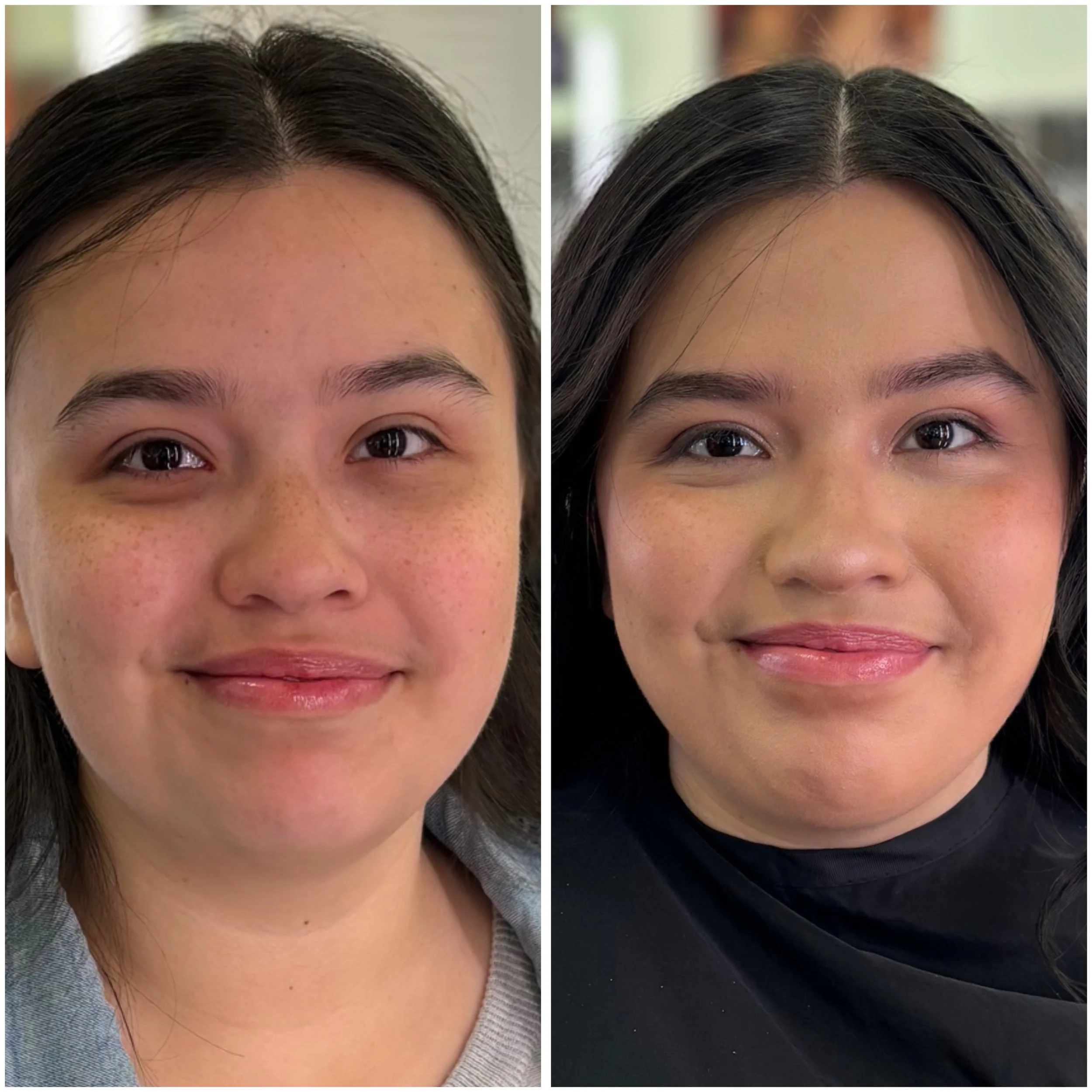 A side-by-side comparison of a woman's forehead and eye area before and after a cosmetic treatment. The left side shows the forehead with visible skin imperfections and uneven skin tone. The right side shows a smoother, clearer complexion with even skin tone and enhanced eyebrow appearance.