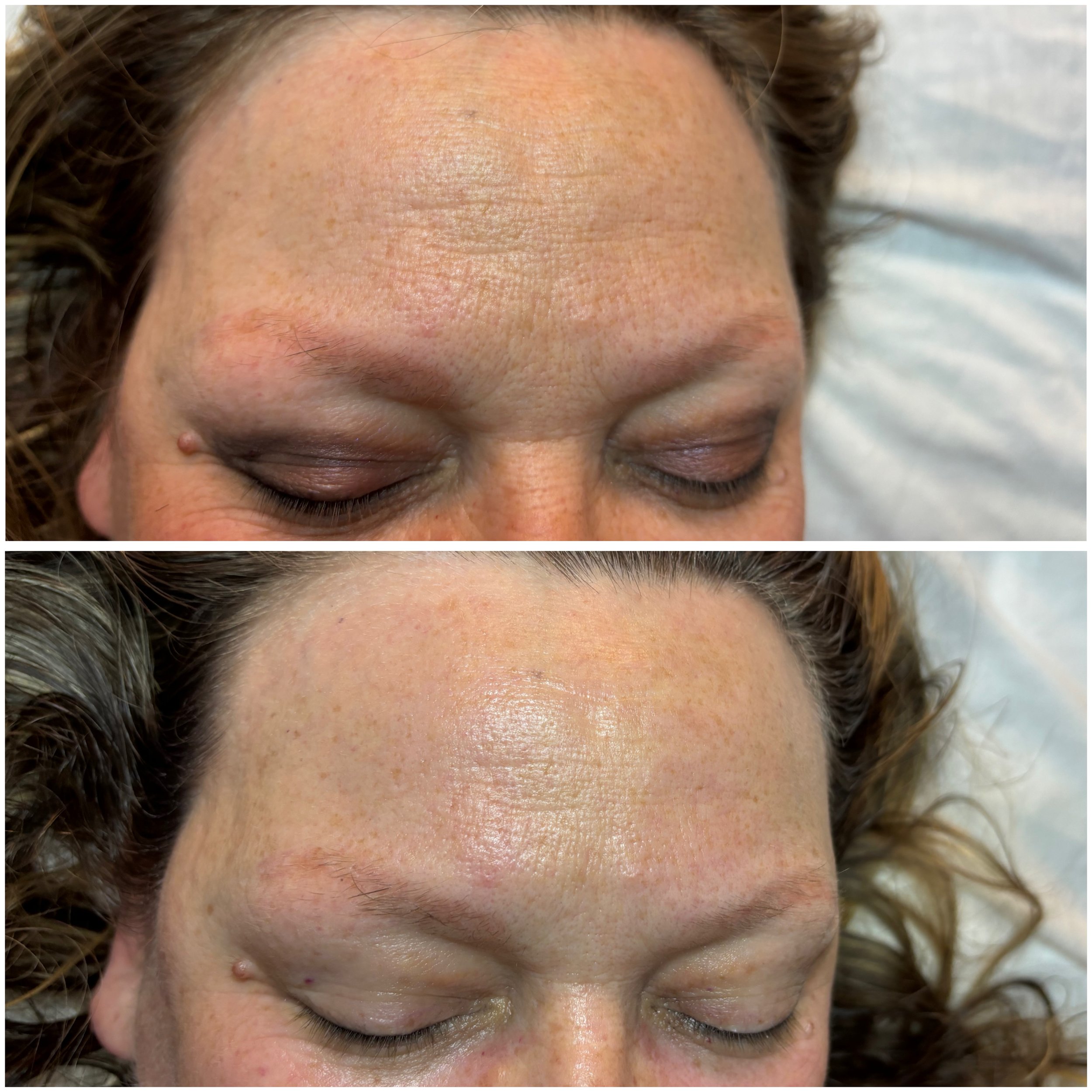 Close-up of a person's forehead with smooth, lightly freckled skin and closed eyes, surrounded by curly hair.