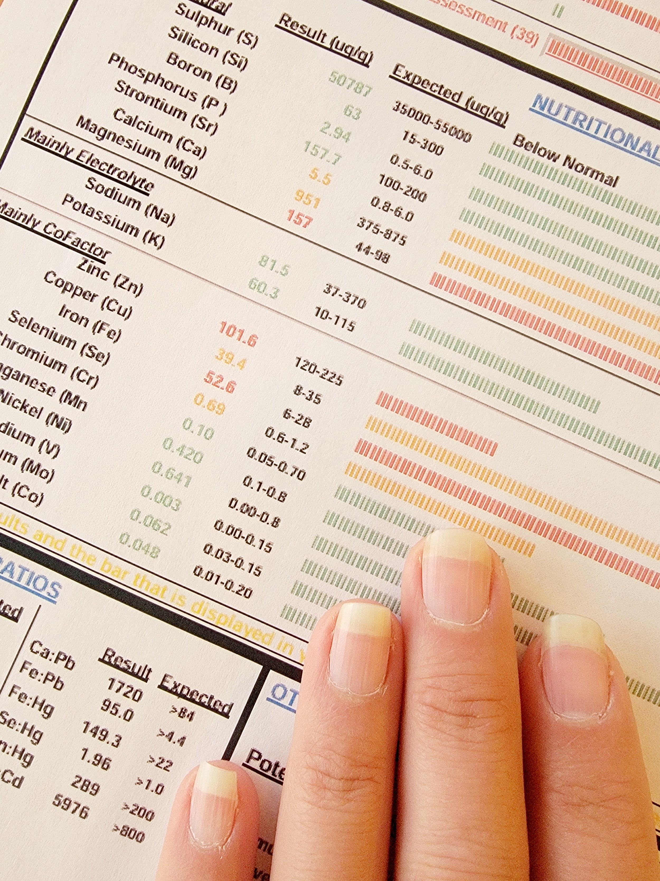 Analyse de résultats nutritionnels sur une feuille avec des chiffres, au centre une main portant deux doigts sur la feuille.