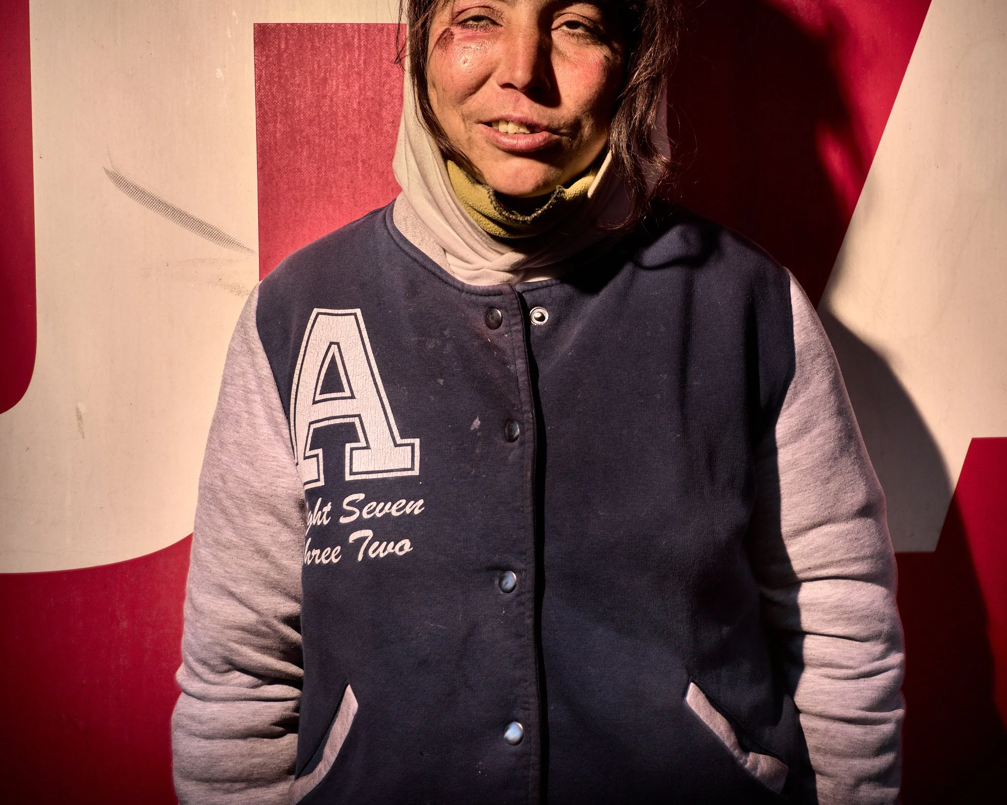 A woman with disheveled hair and scratches on her face, wearing a black and gray varsity jacket, standing in front of a red and white background.