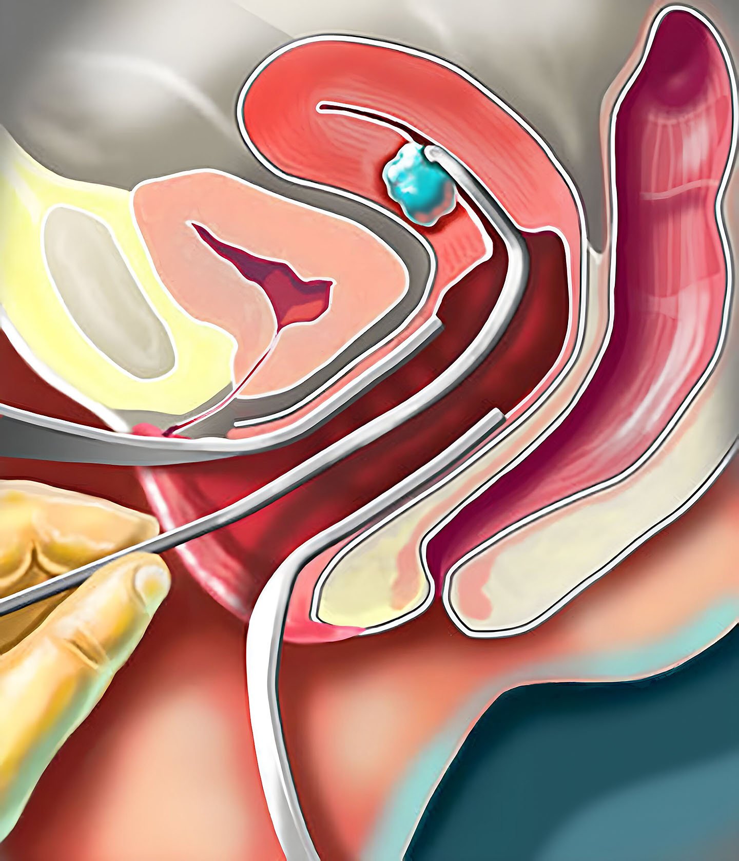 upscaler-gallery-full8-2x.jpg