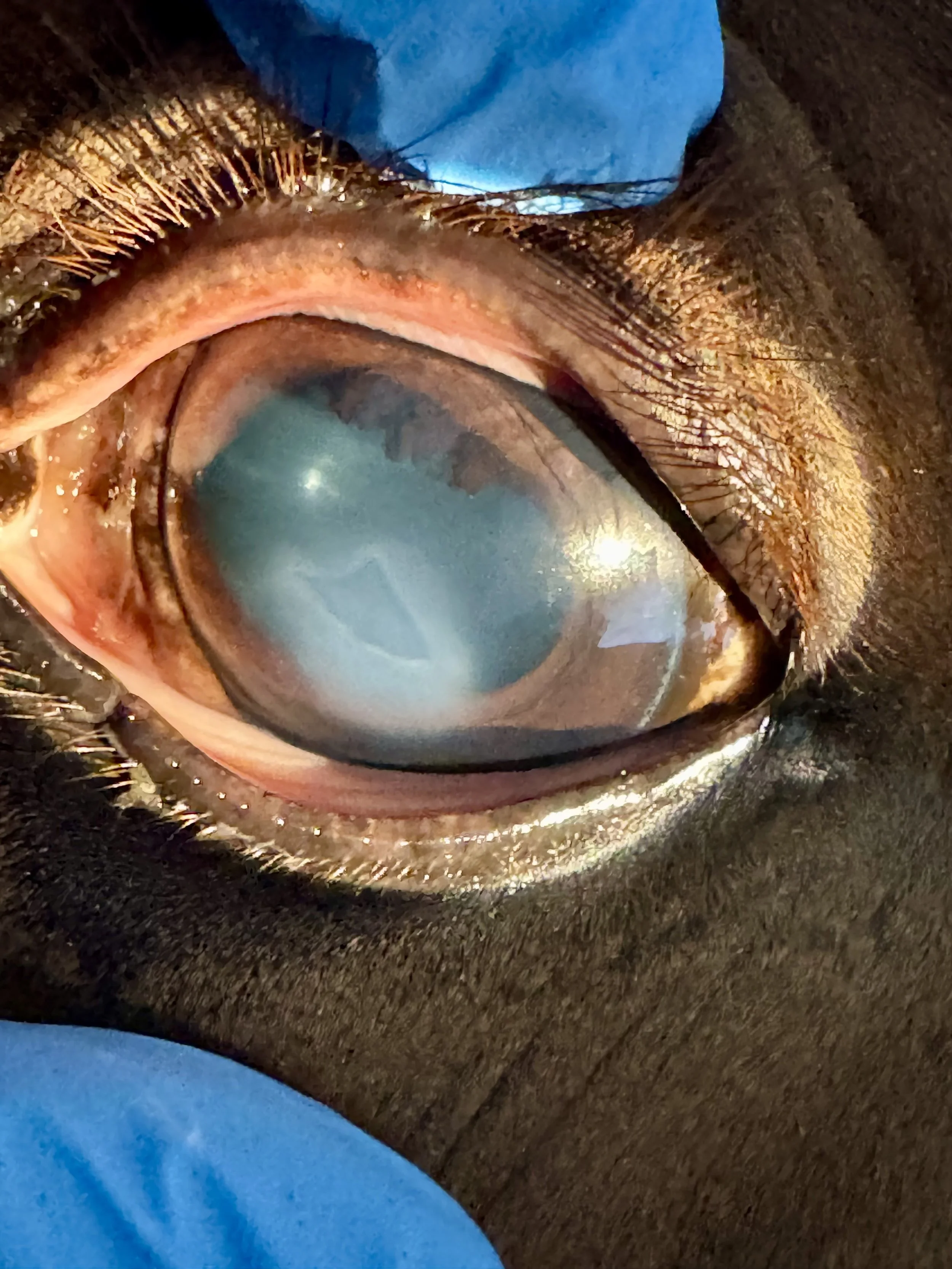 Picture of superficial corneal ulcer with underrun edges