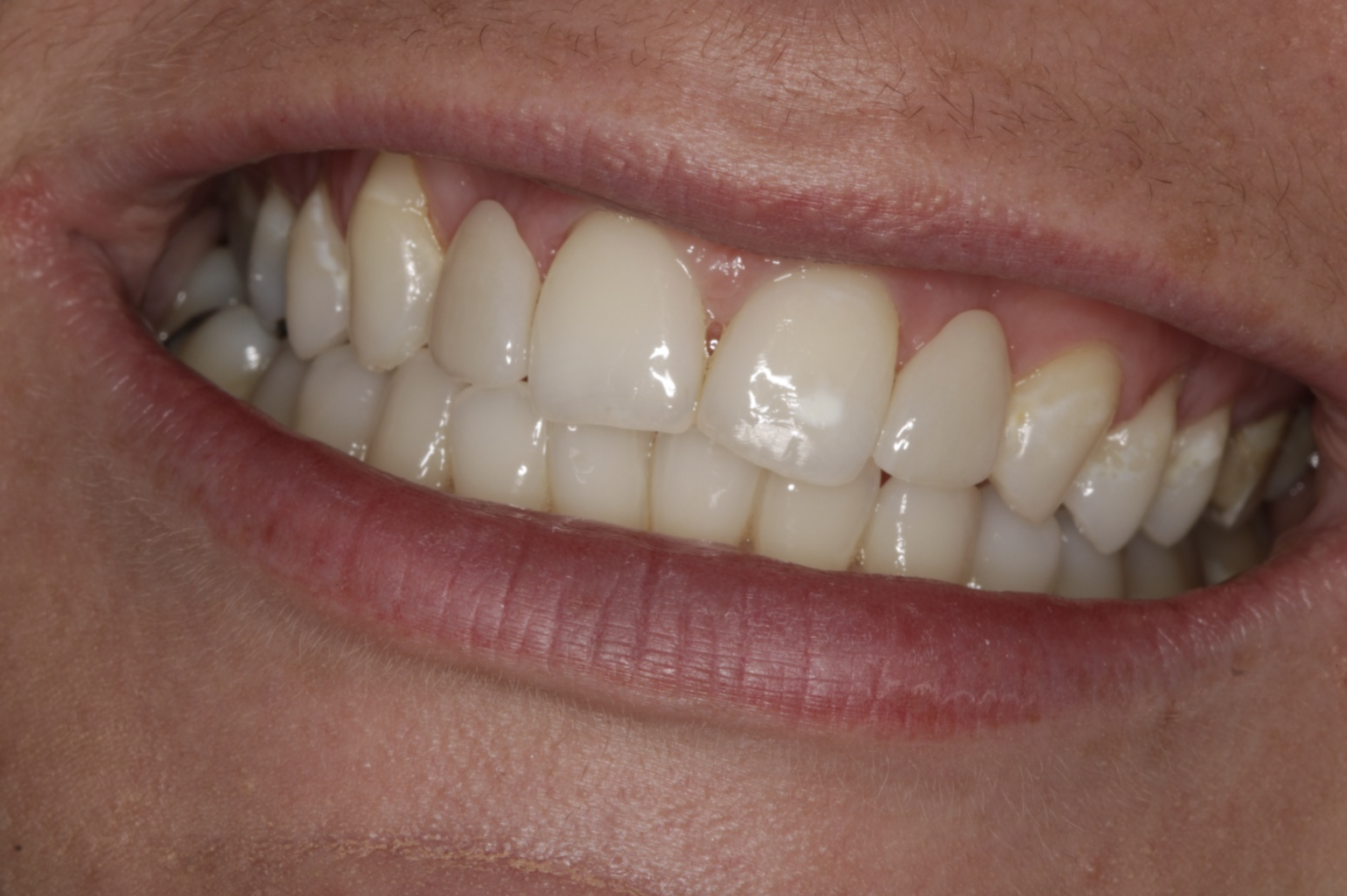 Close-up of a person's smiling mouth showing their teeth and lips.