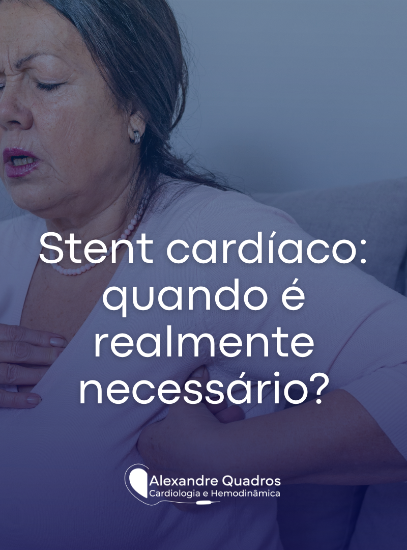 Stent cardíaco: quando é realmente necessário?