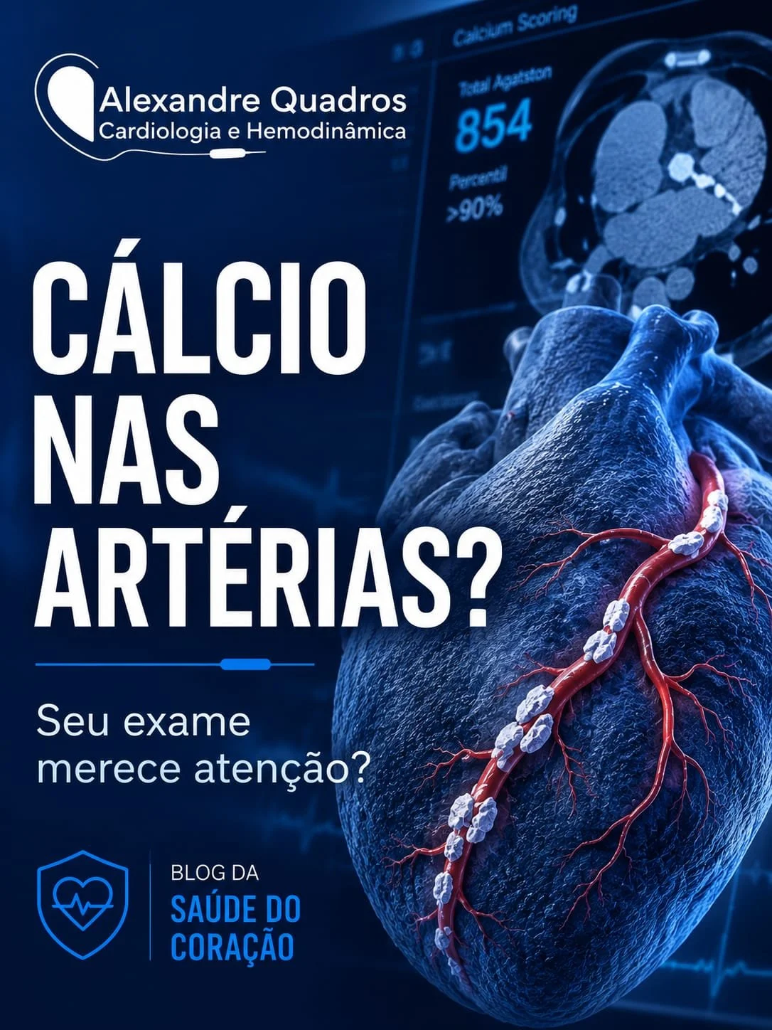 Escore de cálcio elevado: o que significa ter cálcio nas artérias do coração?