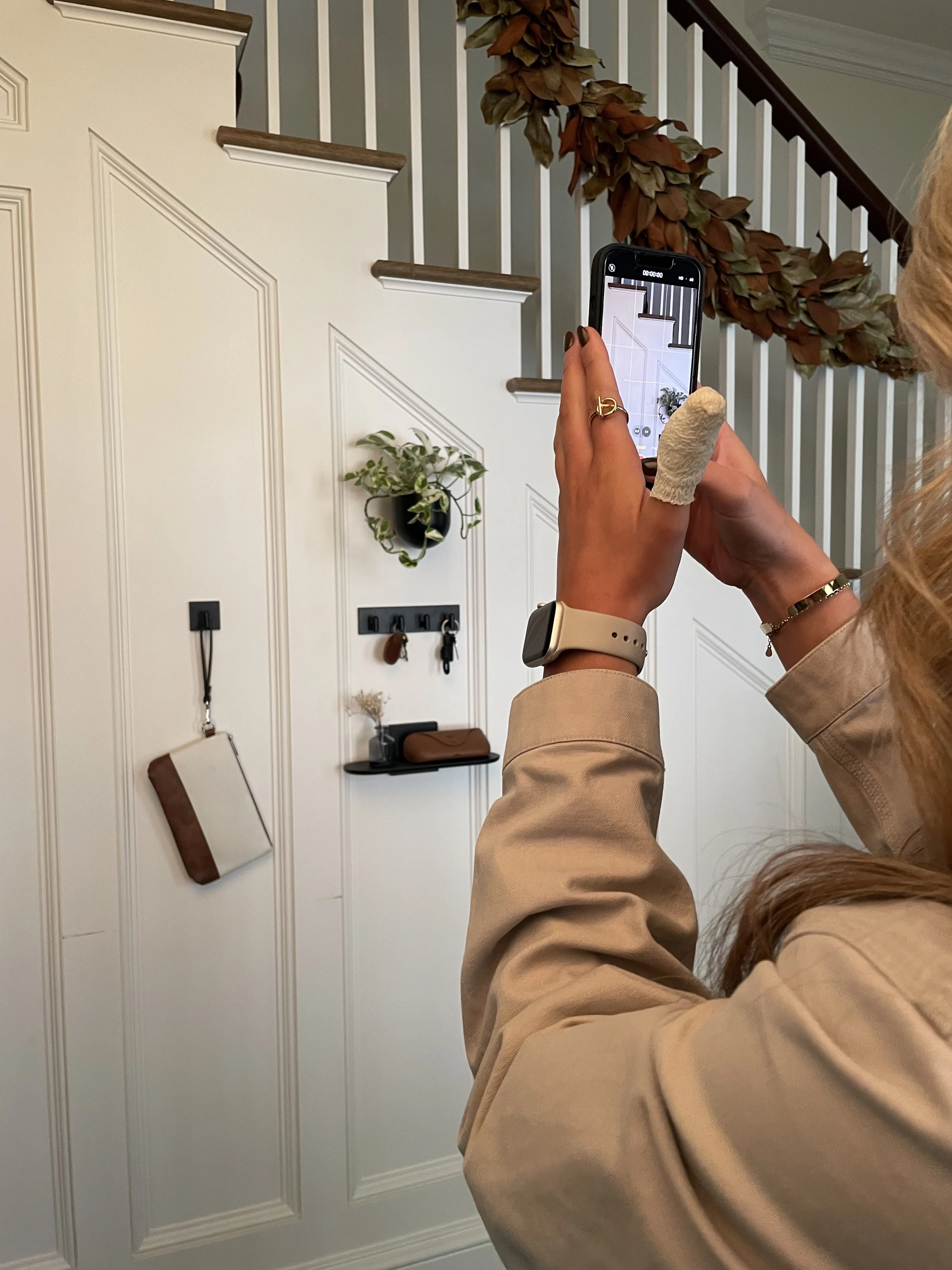 An inconvenient injury didn't stop the client's socials