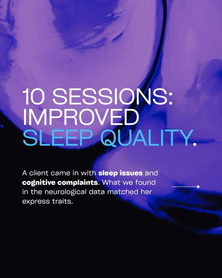 This is what neuroplasticity looks like. 🧠

A client came to me wanting to improve her sleep quality and cognitive performance. When we ran her brain assessment, the data told an interesting story.
Her delta and theta waves (the brainwaves we associ