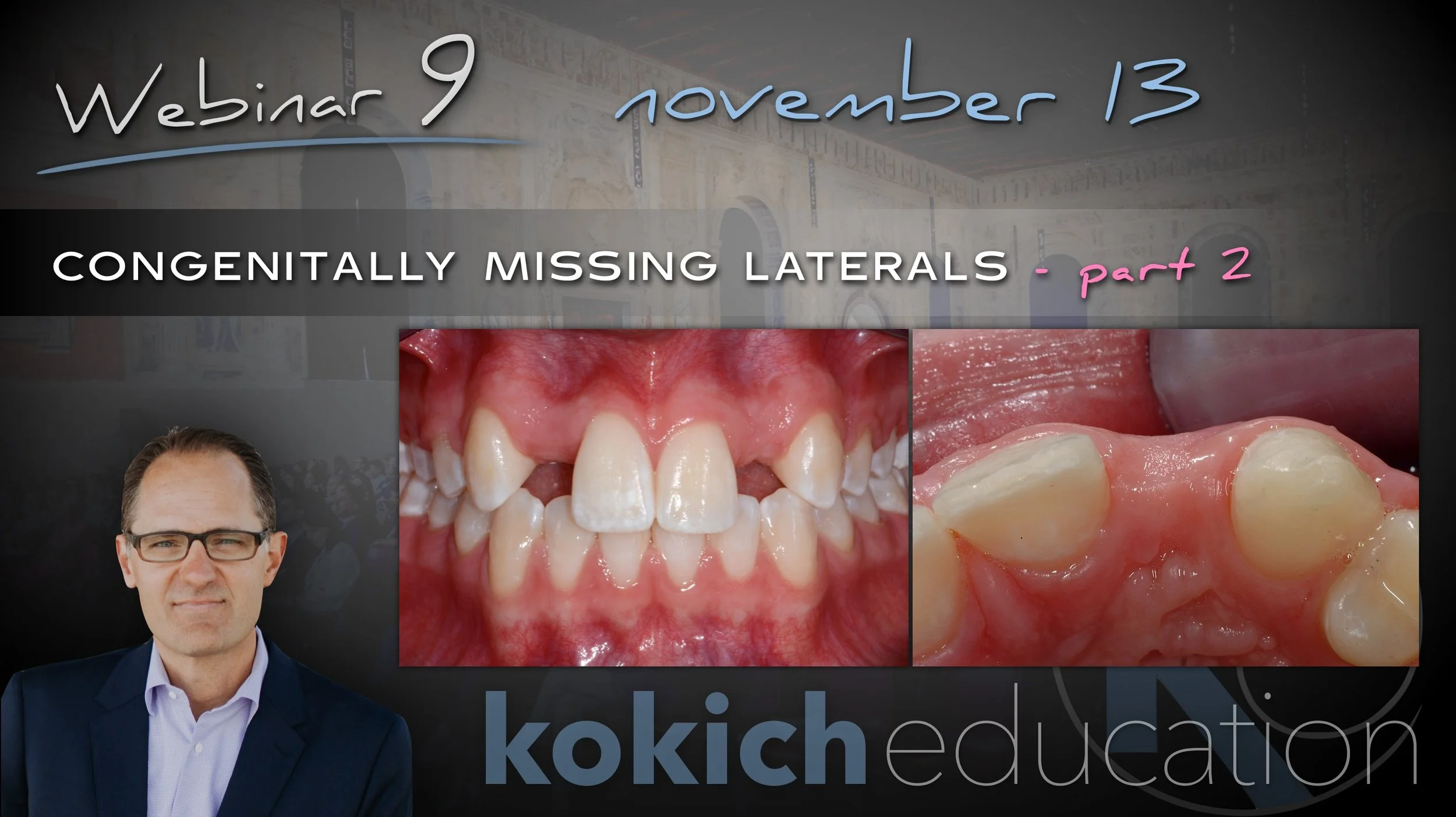 Congenitally Missing Laterals Part 2