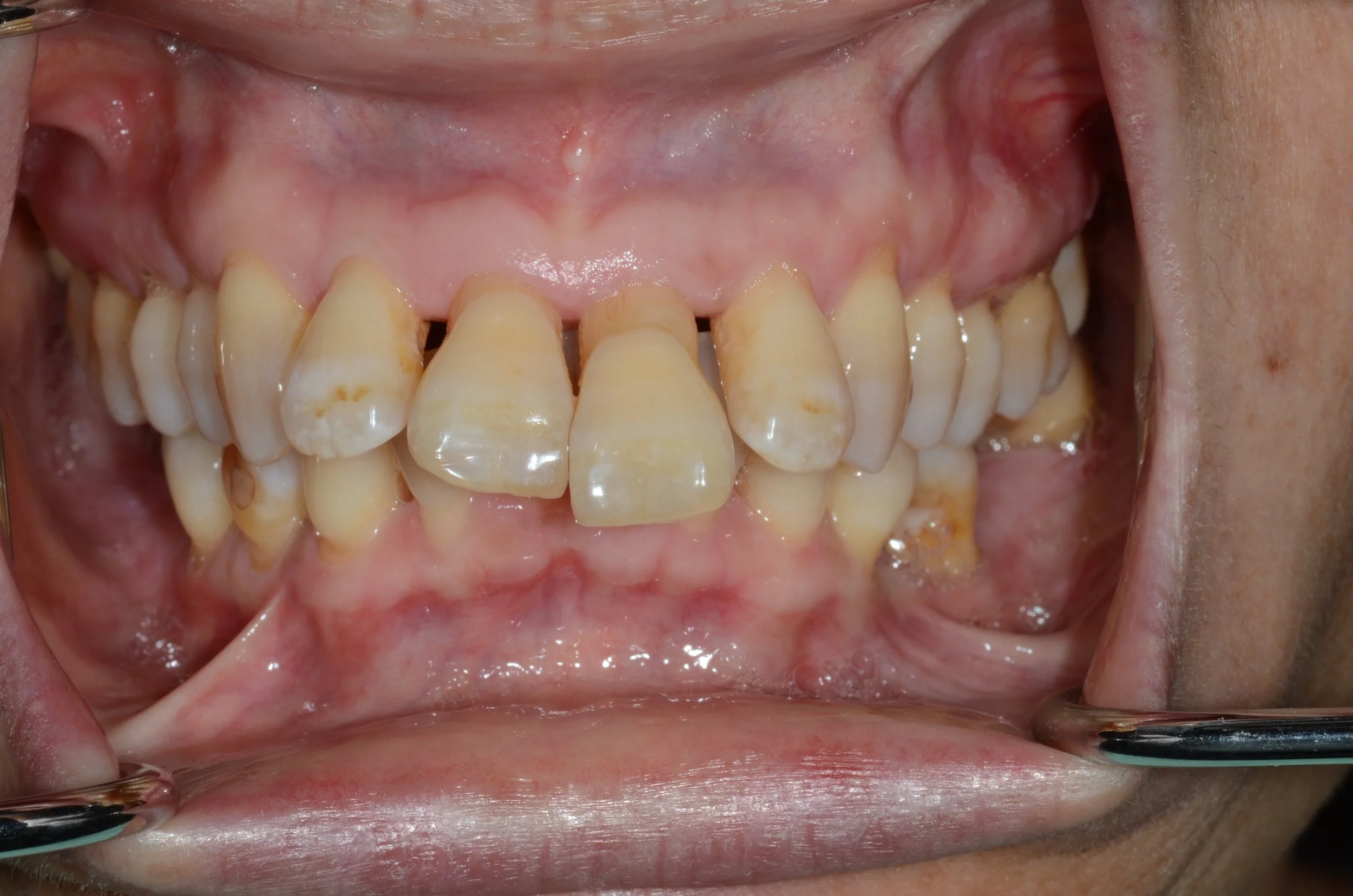 Setting Realistic Treatment Objectives - May 7th