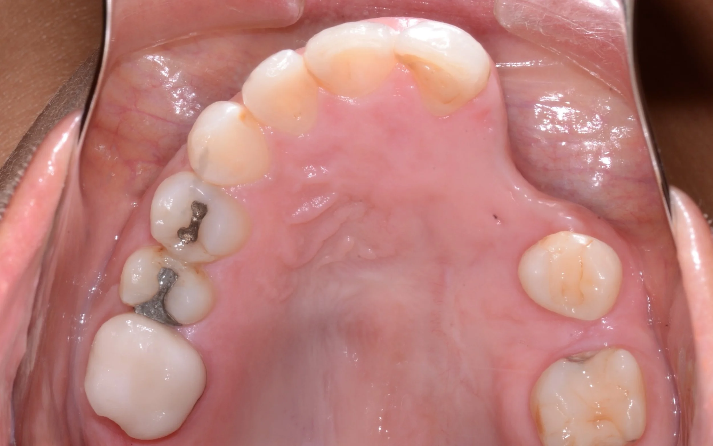 Orthodontic Failures - Oversight, Under-treatment or Communication Breakdown - September 17th