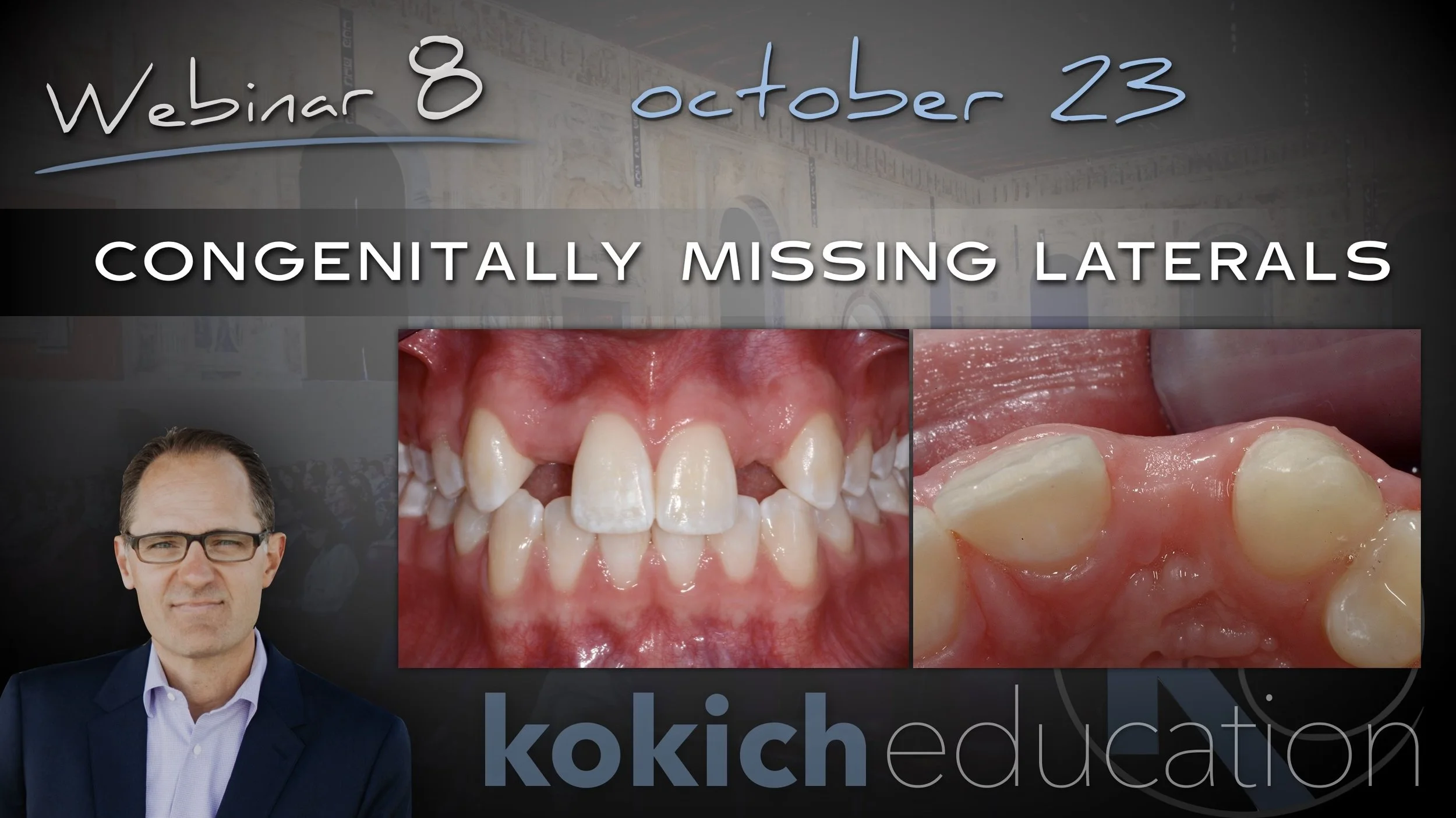 Congenitally Missing Laterals - PART 1