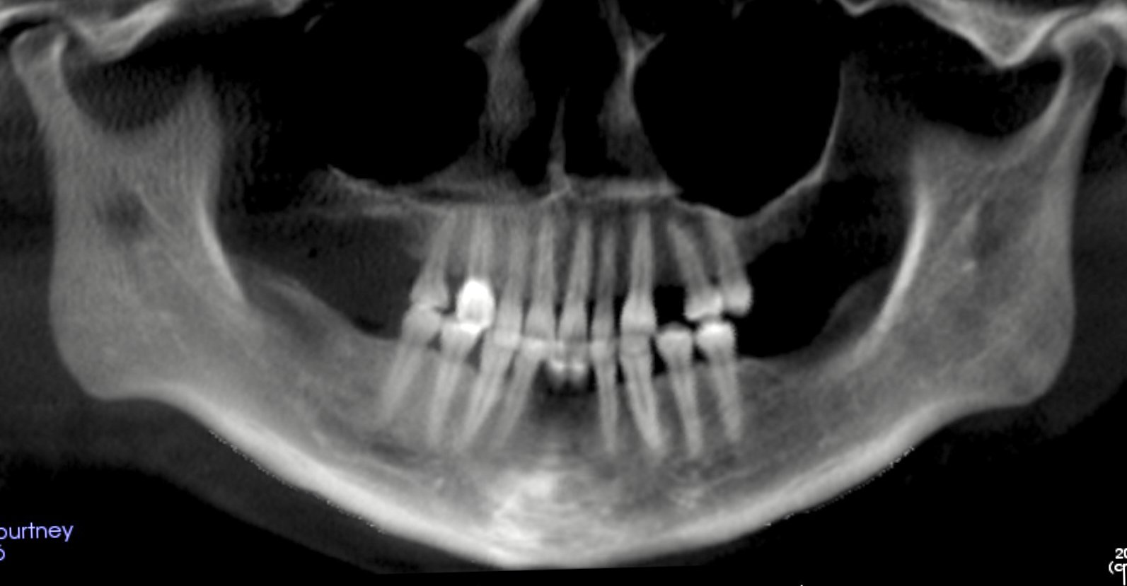 Congenitally missing teeth - C. Browne.jpeg