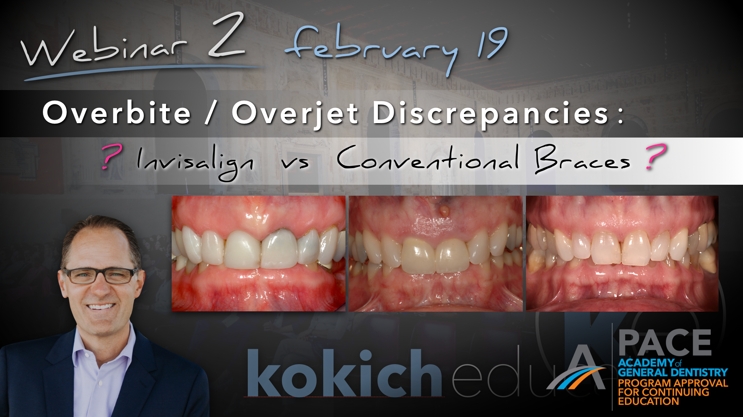 Overbite/Overjet Discrepancies - Invisalign vs Conventional Braces? (CE Eligible)