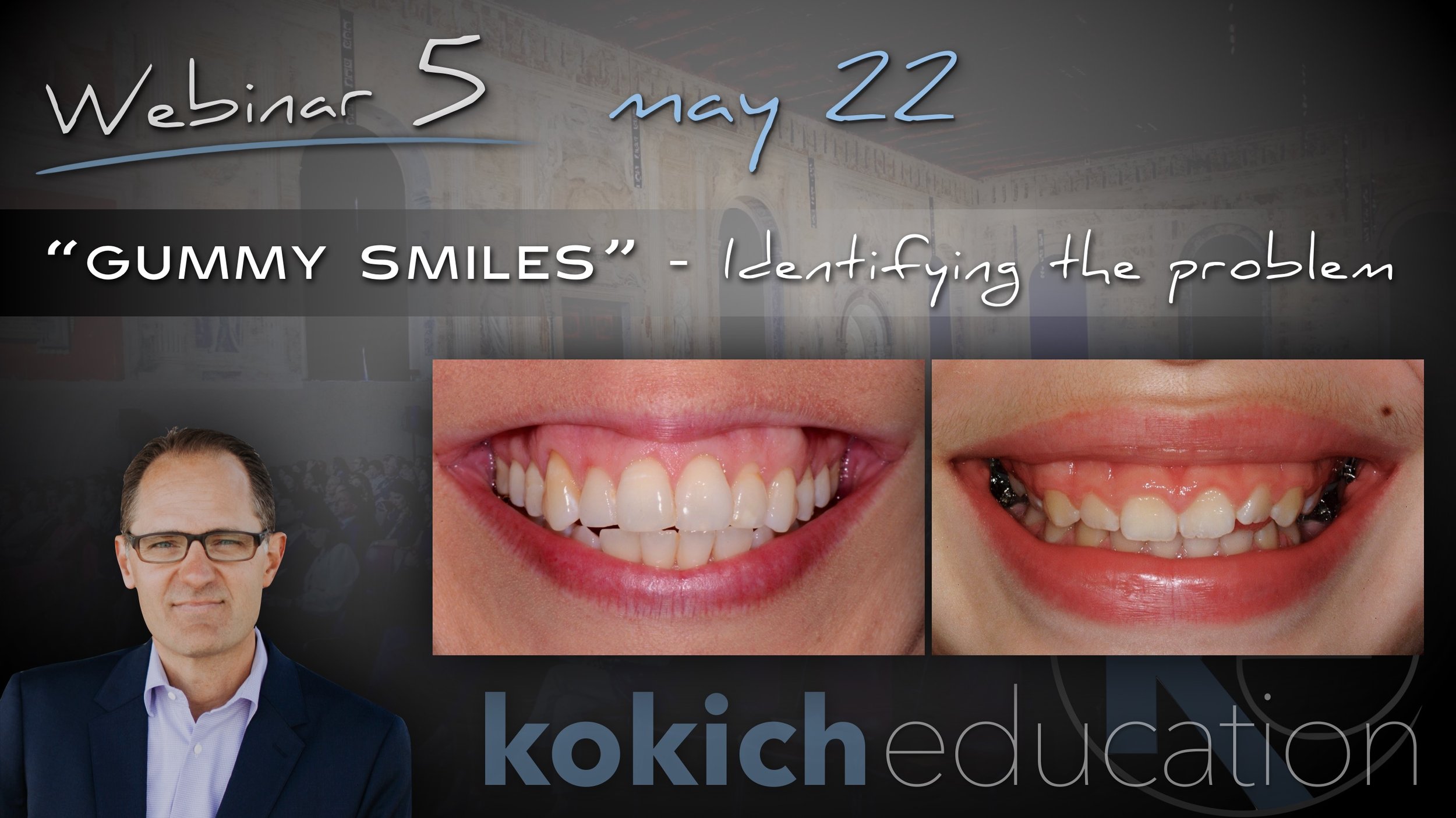 Managing Gummy Smiles Part 1