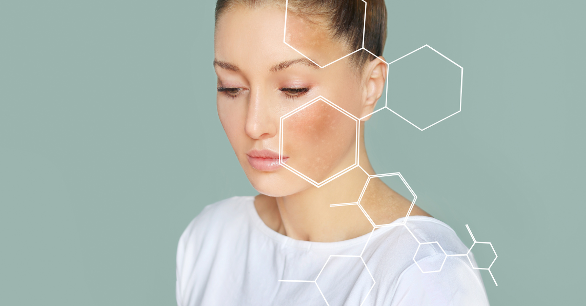 A woman with her eyes closed, wearing a white shirt, with graphic hexagons overlaying her face suggesting skincare or dermatology.