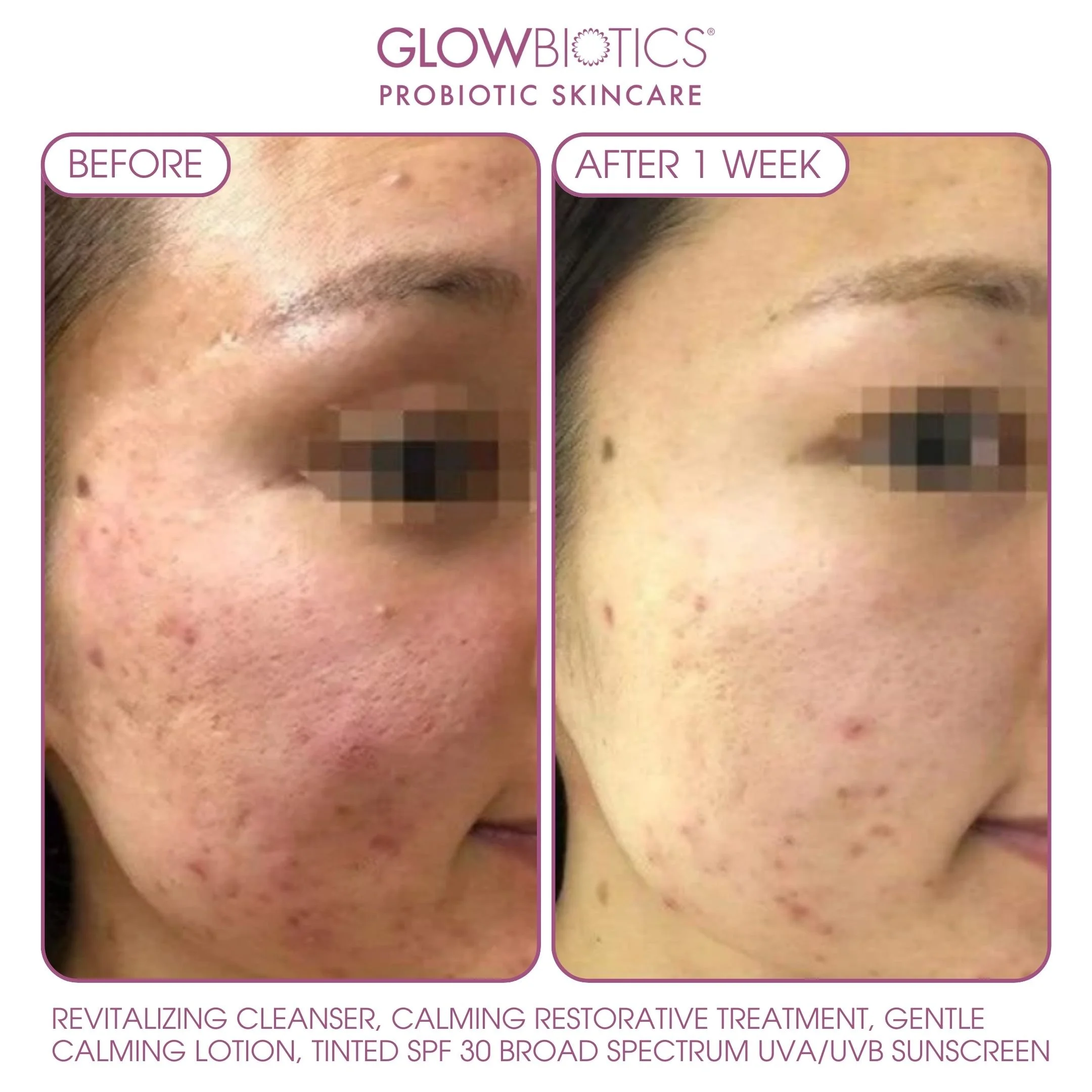 B&A - Slide 4 - BC.jpg