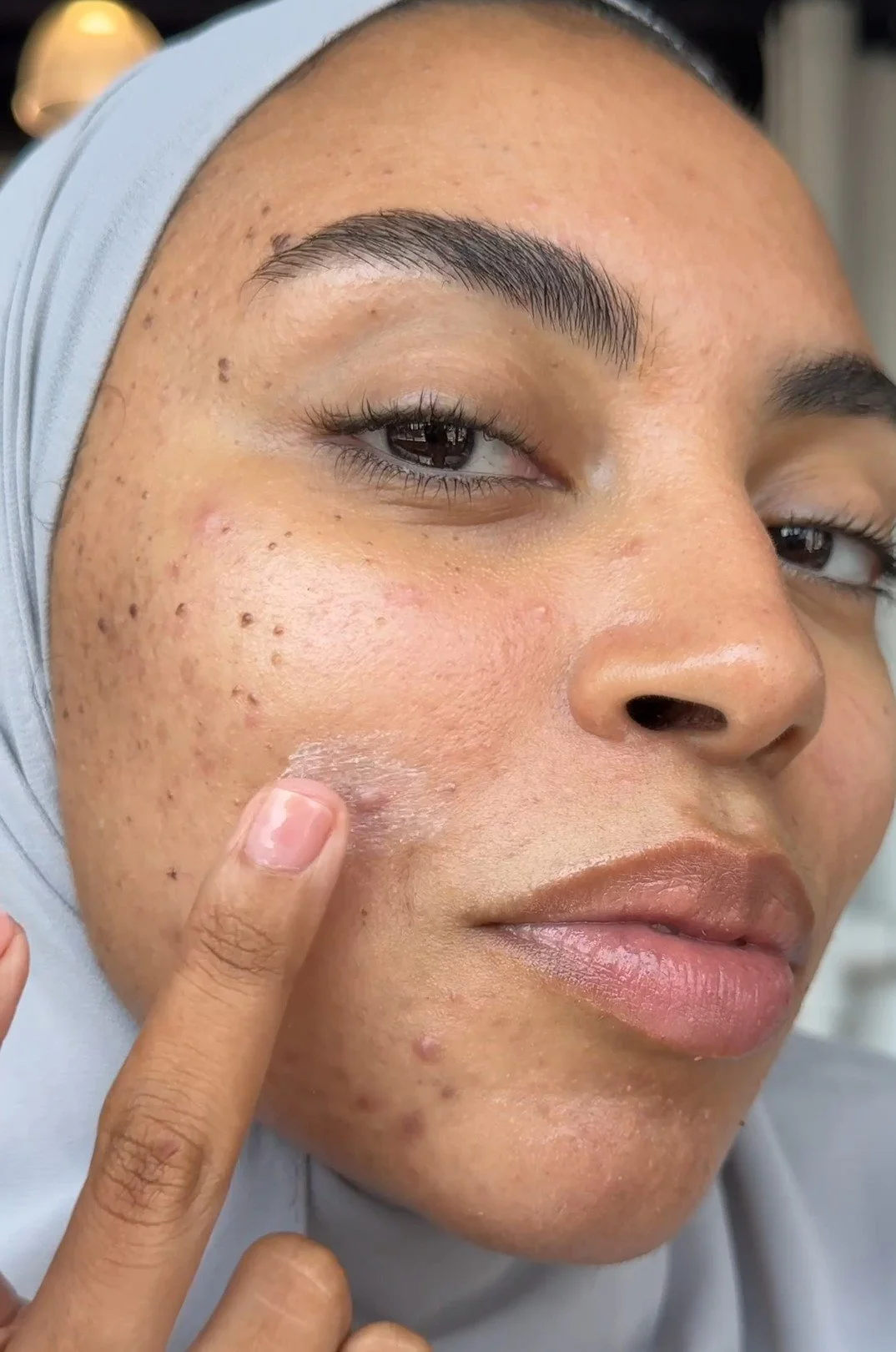 Sarita SkinFix Thumb 7.jpg