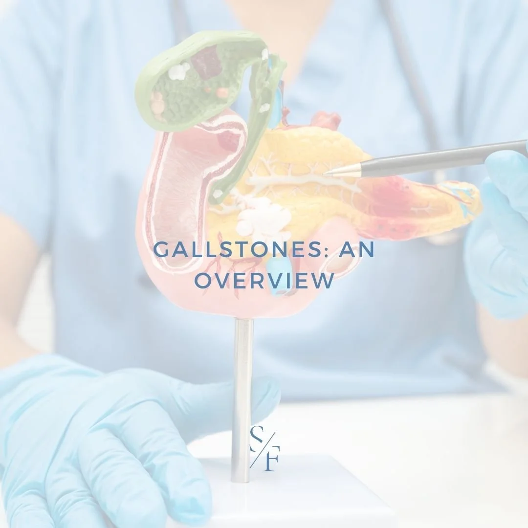 Gallstones: An Overview