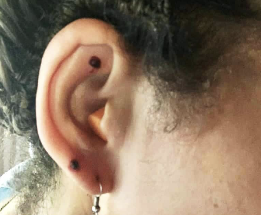 Close-up of an ear with kambo and a hoop earring in the lobe.