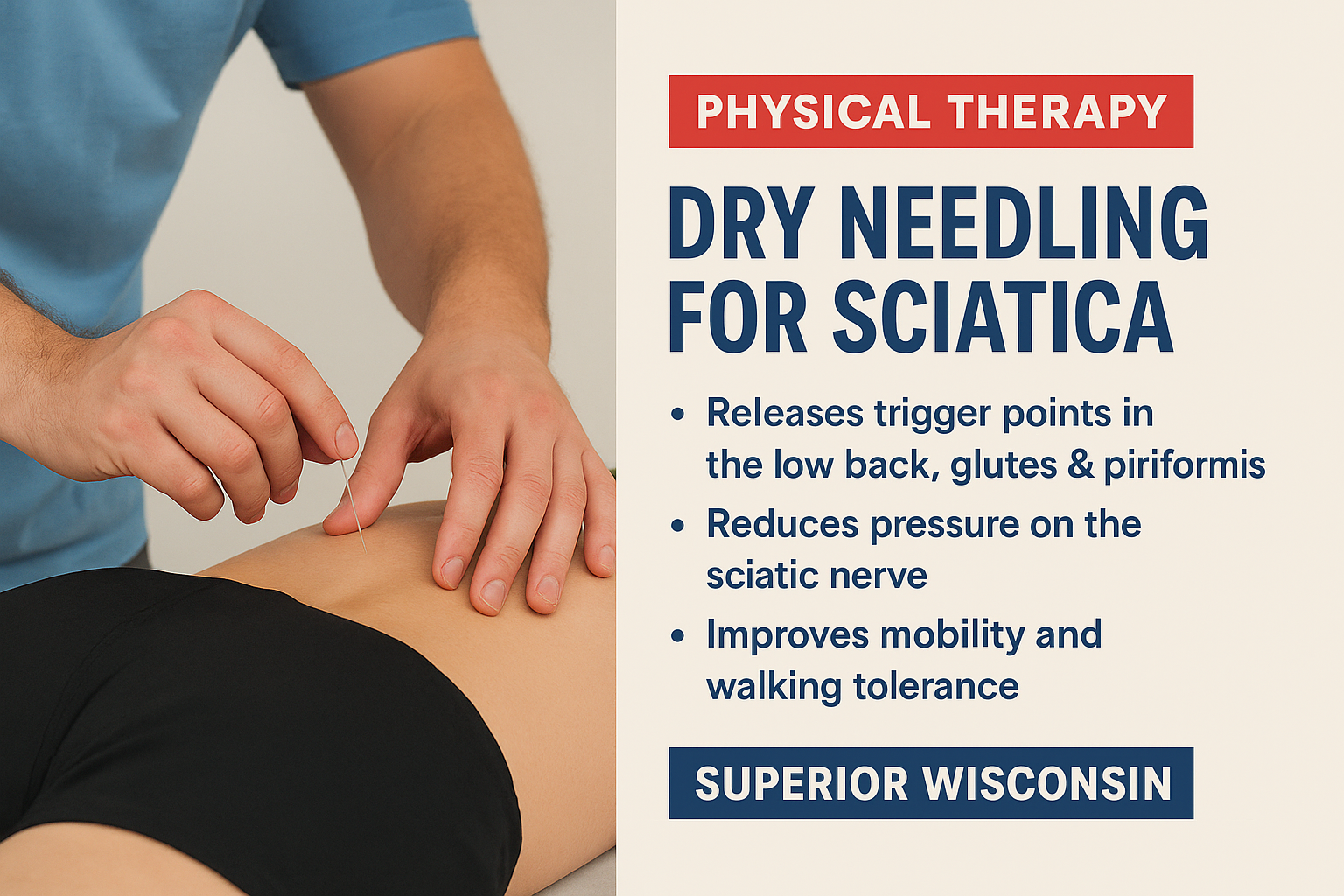 Dry Needling for Sciatica: A Powerful Physical Therapy Solution in Superior, Wisconsin (Copy)