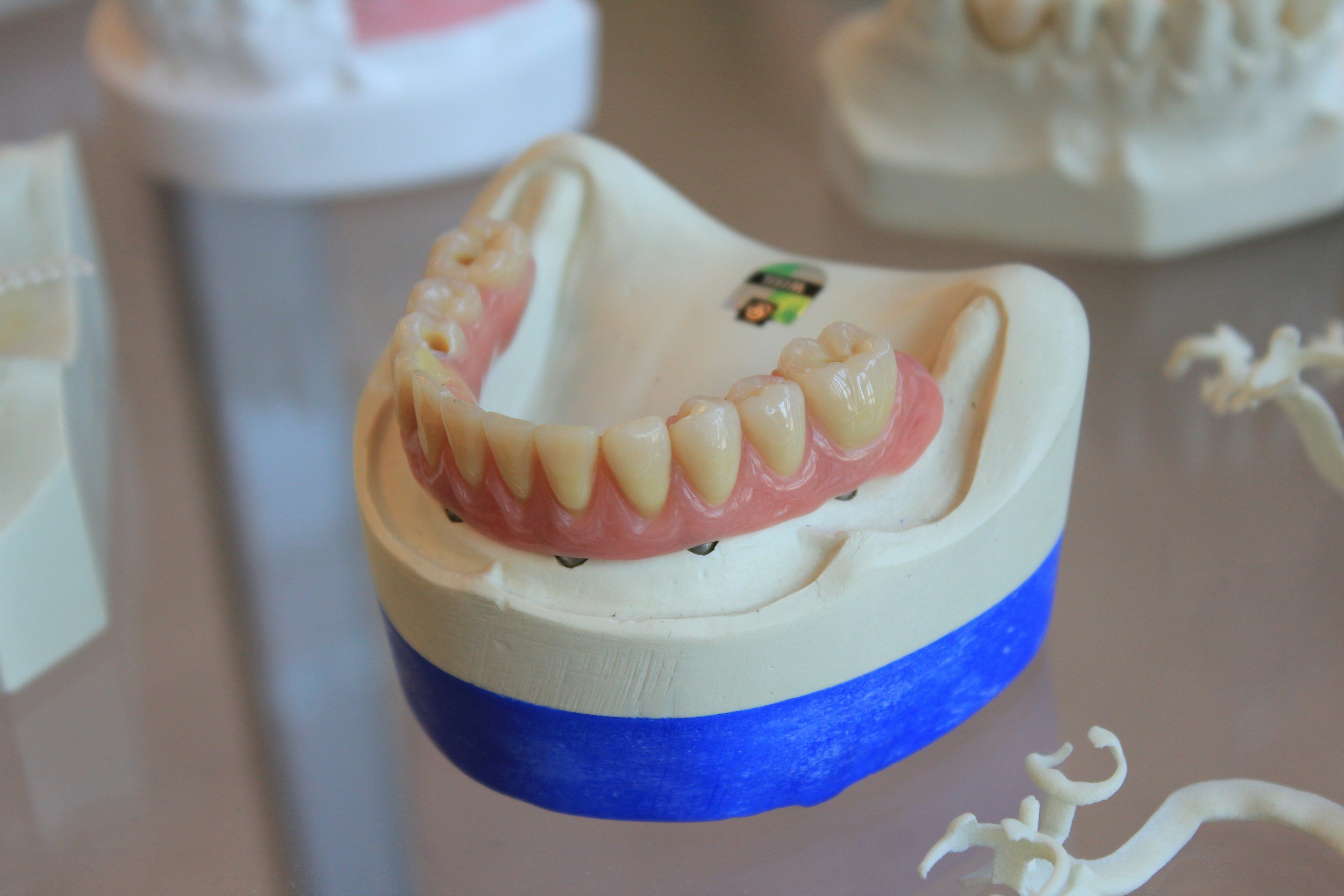 Dental model showing lower teeth